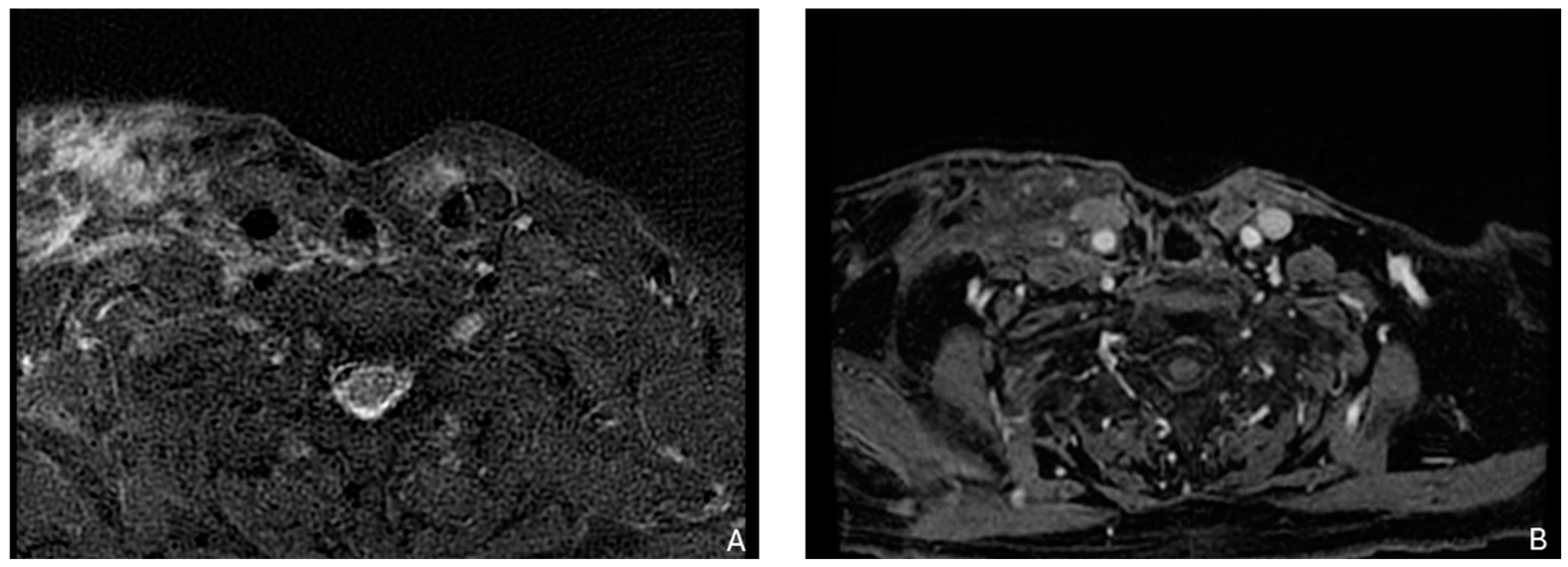 Biomedicines 12 02080 g002 Biomedicines 12 02080 g002