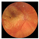 Biomedicines 12 02092 i013