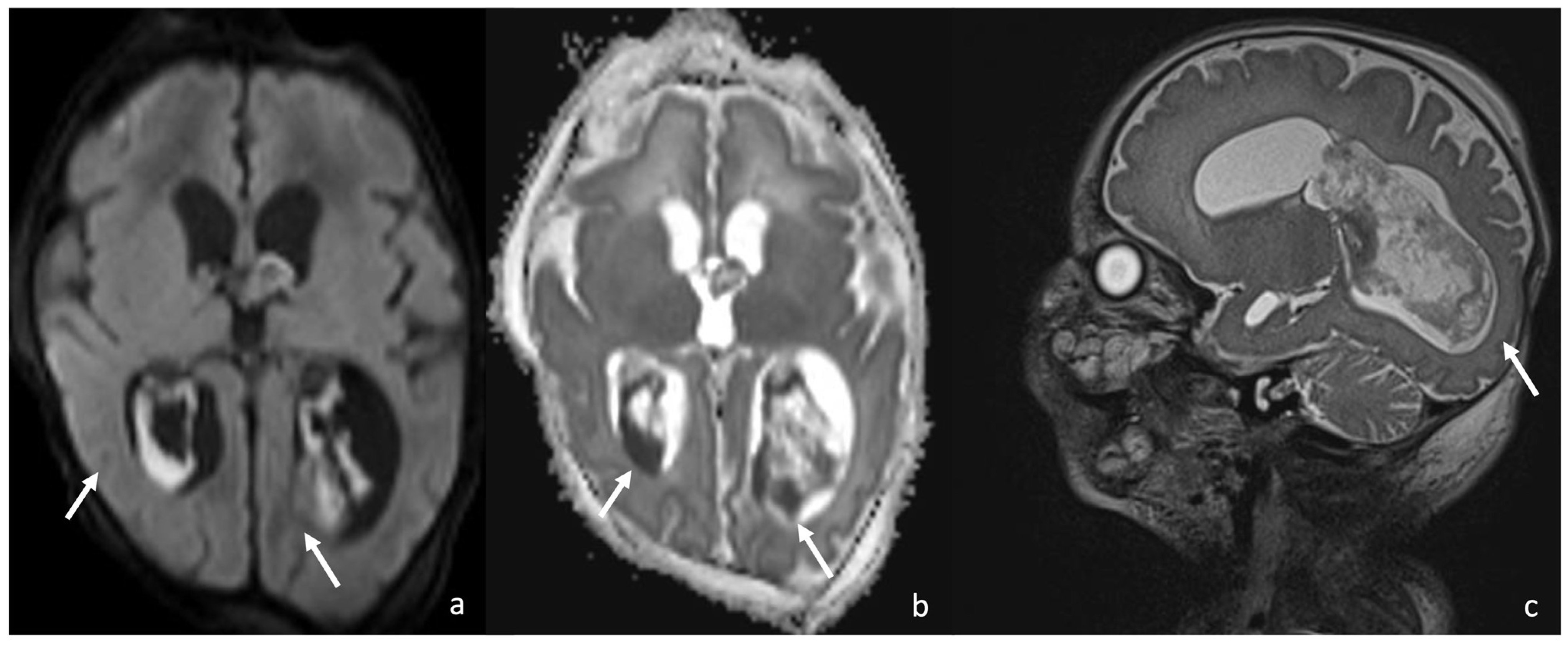 Biomedicines 12 02490 g002