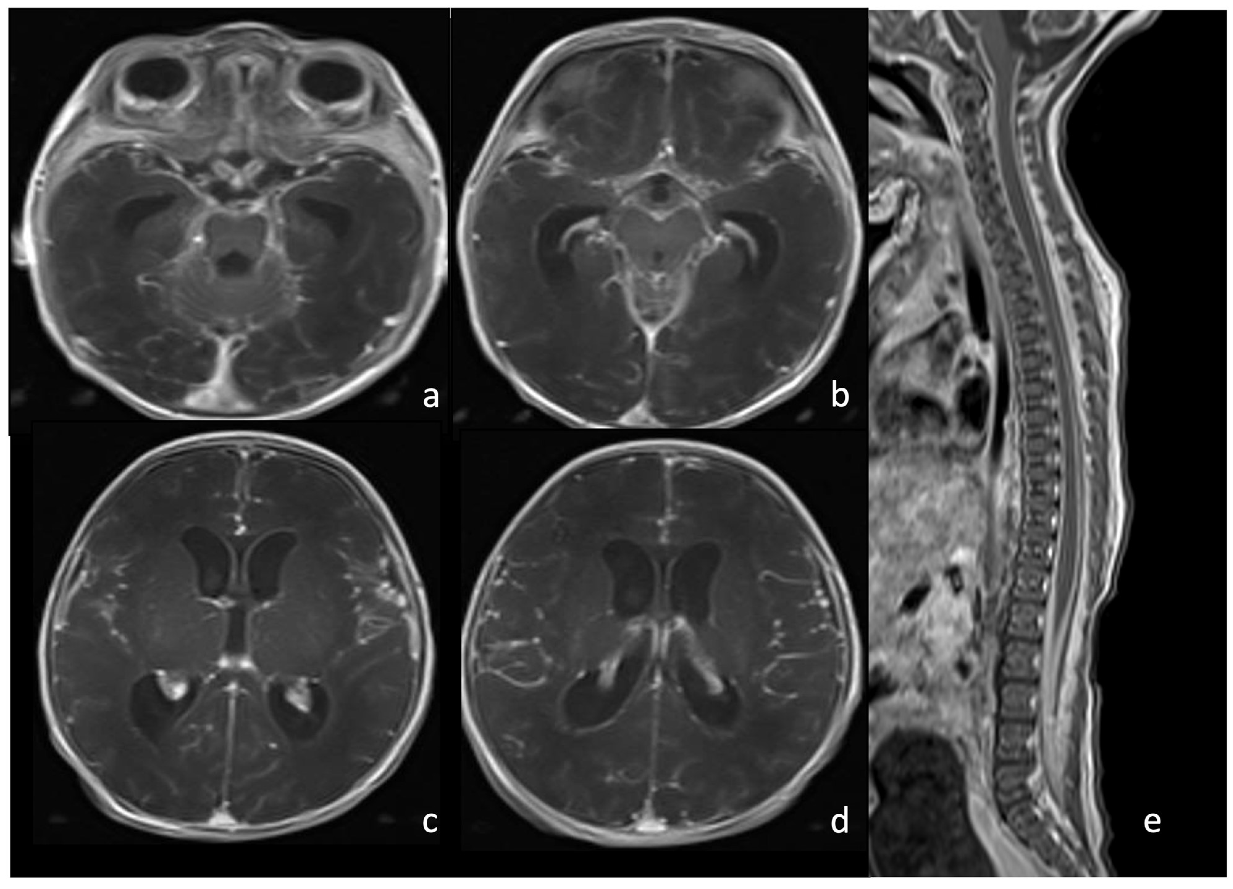 Biomedicines 12 02490 g004