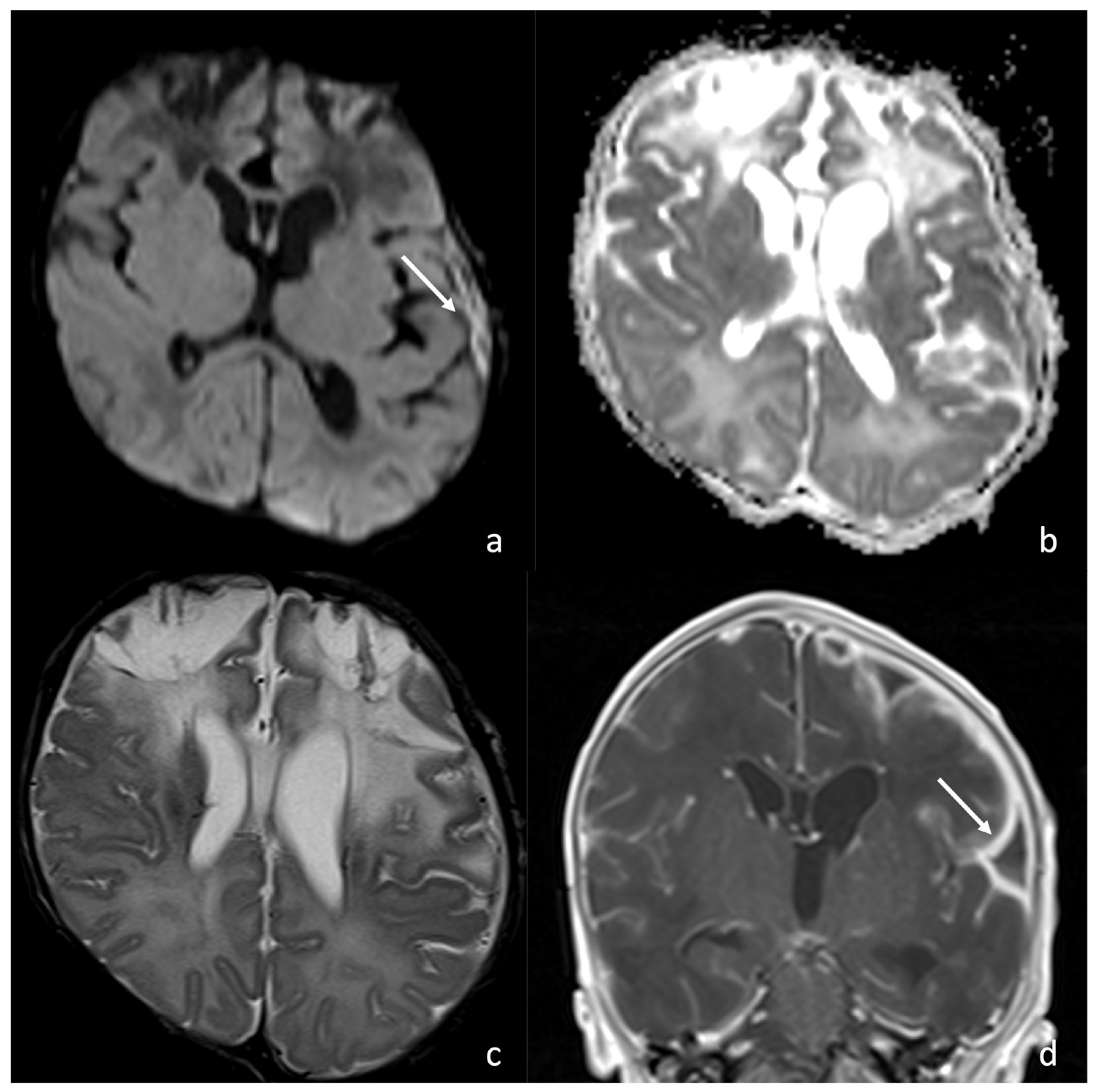 Biomedicines 12 02490 g007