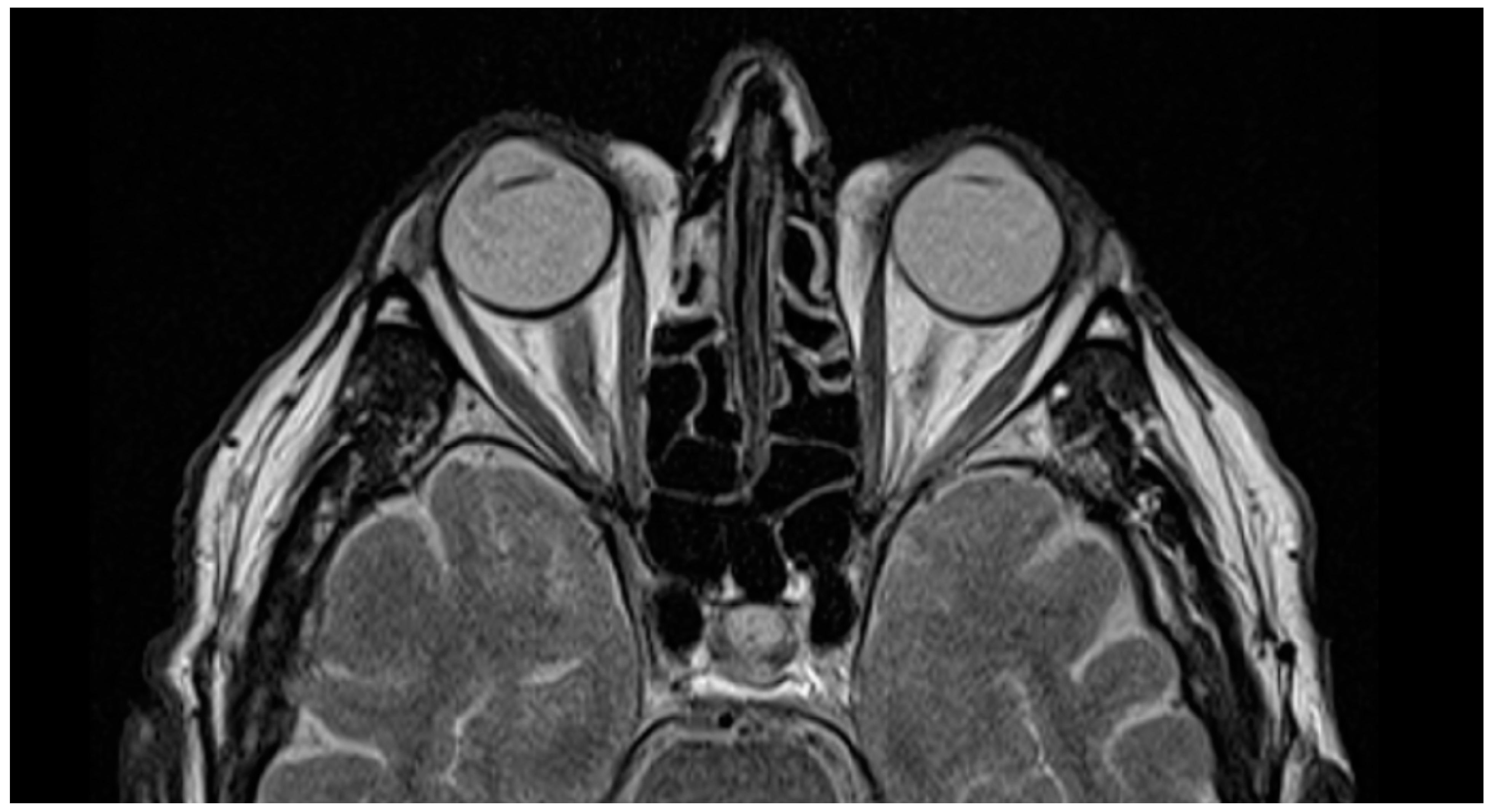 Biomedicines 13 00162 g005