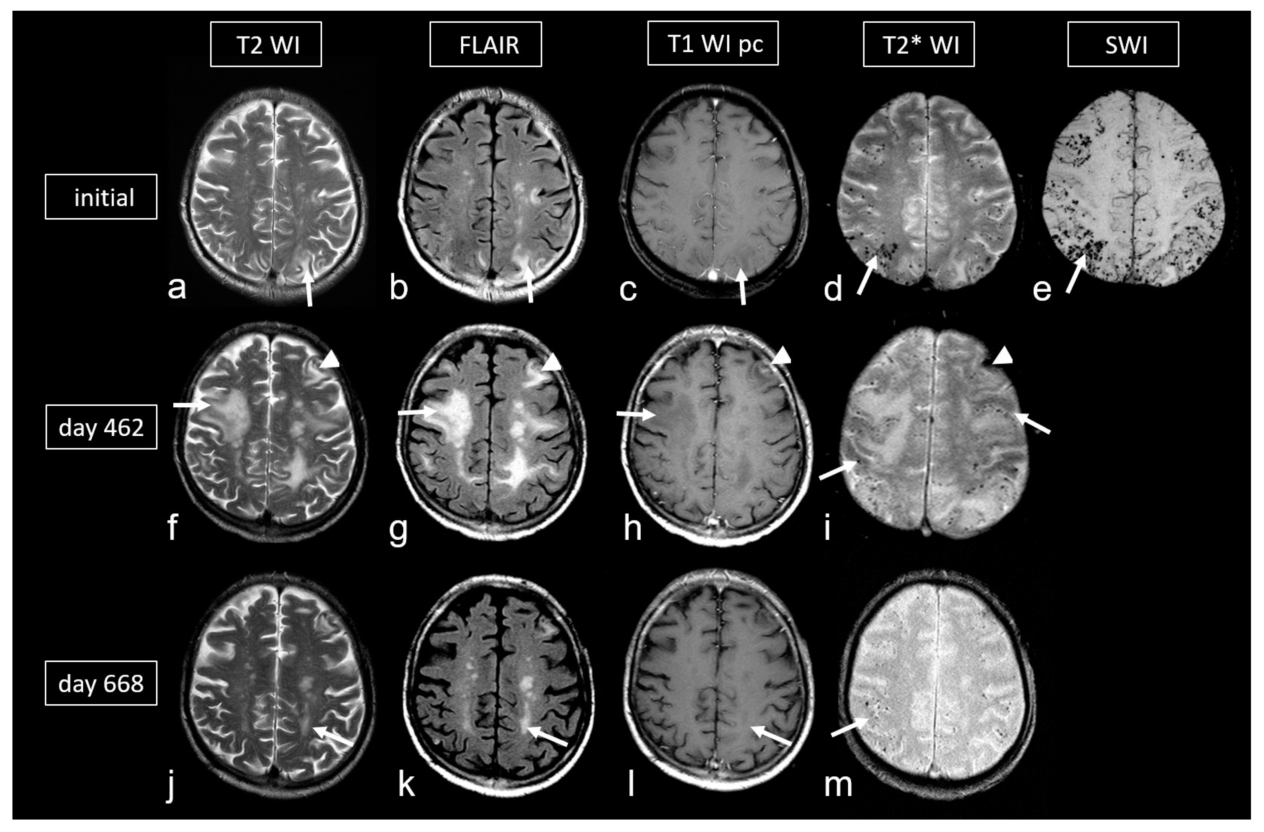 Biomedicines 13 00603 g006