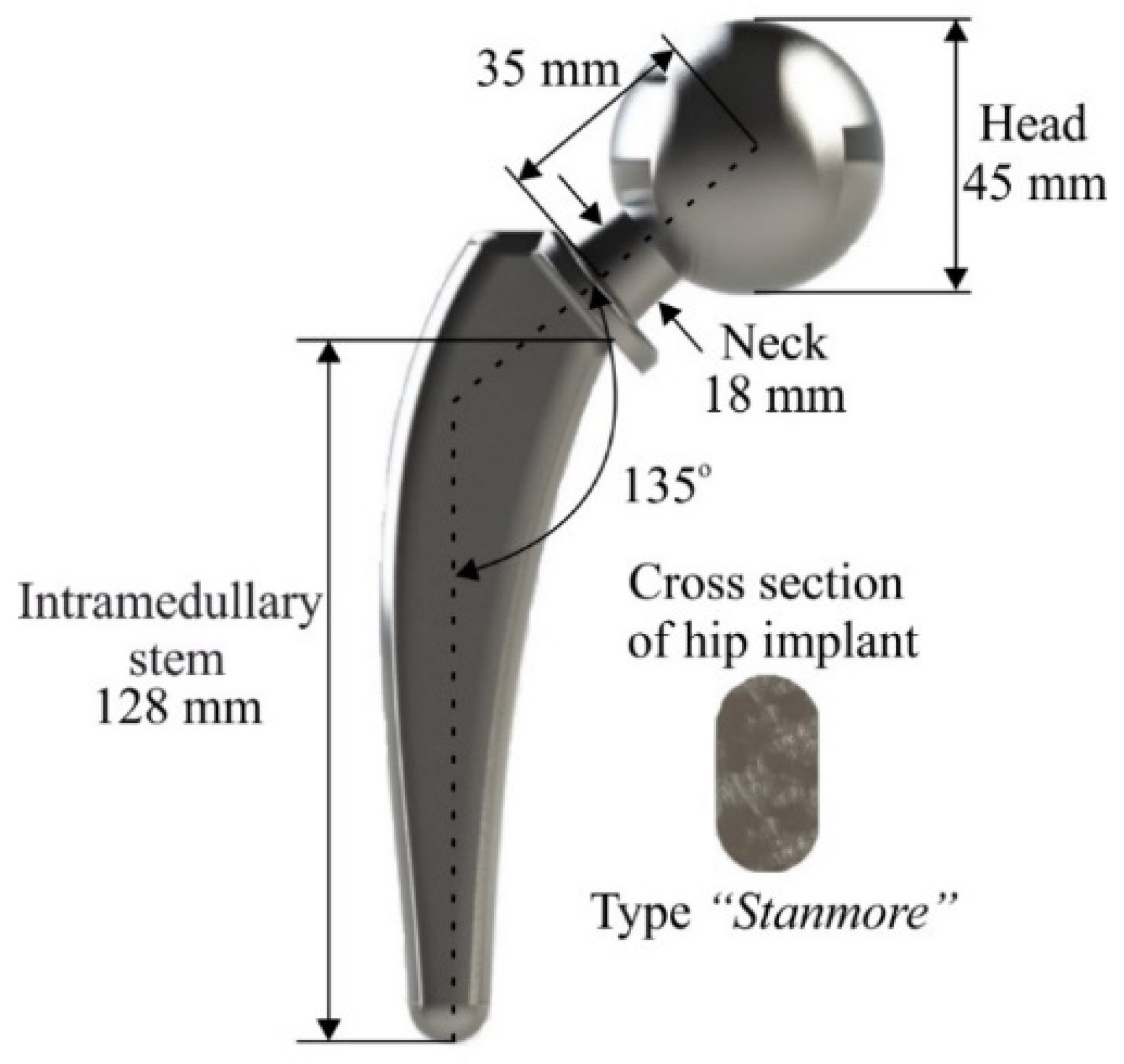 Biomimetics Free Full Text Finite Element Analysis Of Orthopedic