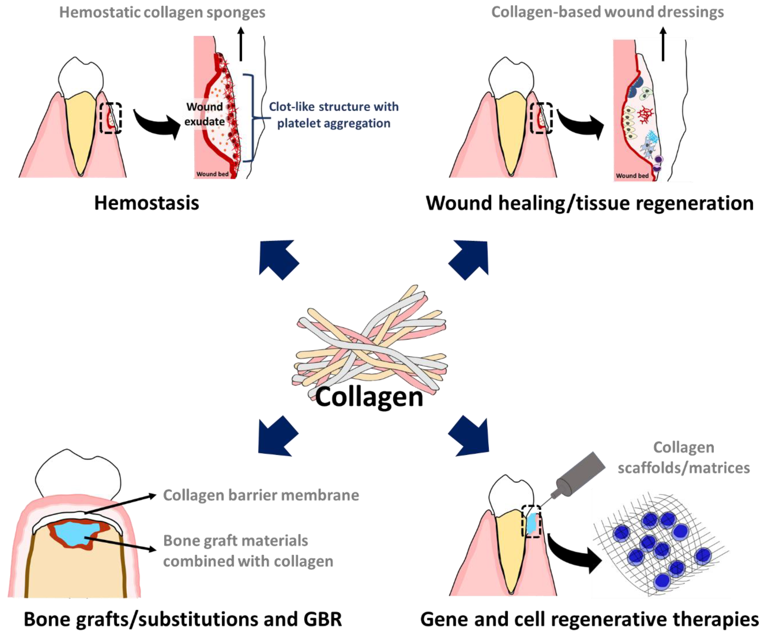 Biomimetics | Free Full-Text | Collagen-Based Biomaterials in Periodontal  Regeneration: Current Applications and Future Perspectives of Plant-Based  Collagen