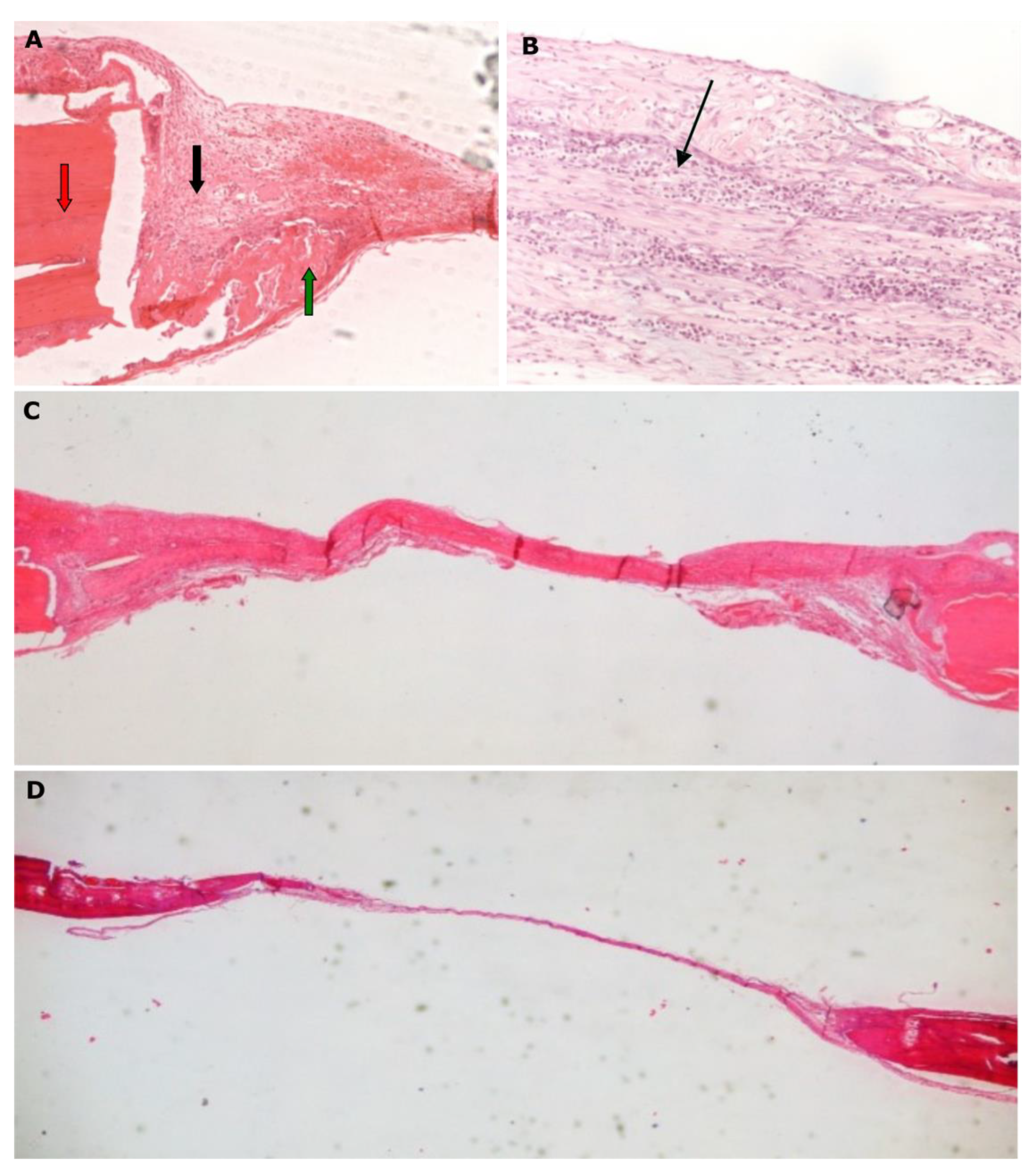 Effect of Meloxicam and Diclofenac Sodium on Peri‐Implant Bone Healing in  Rats - Pablos - 2008 - Journal of Periodontology - Wiley Online Library