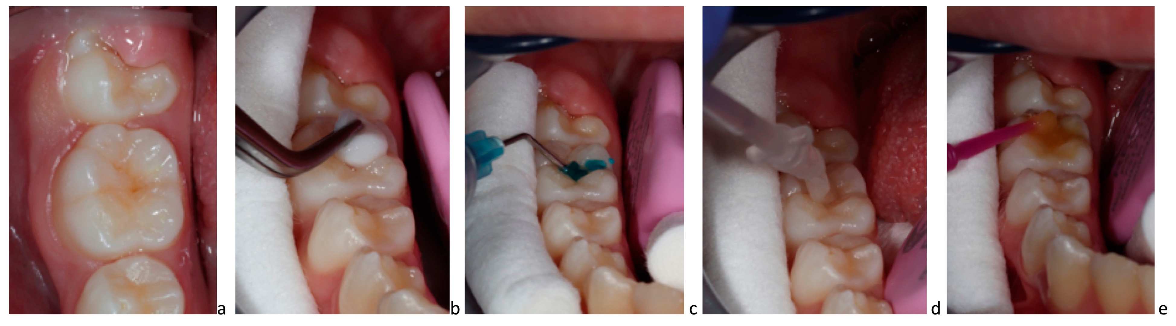 Biomimetics 08 00290 g003 Biomimetics 08 00290 g003