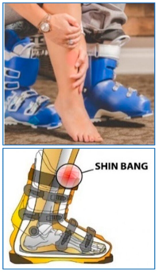 Pneumatic walking boot (long) - Code: EME - 091 - Edrees Medical