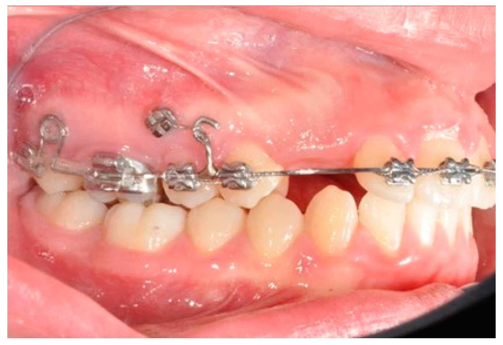 Biomimetics 09 00305 g004