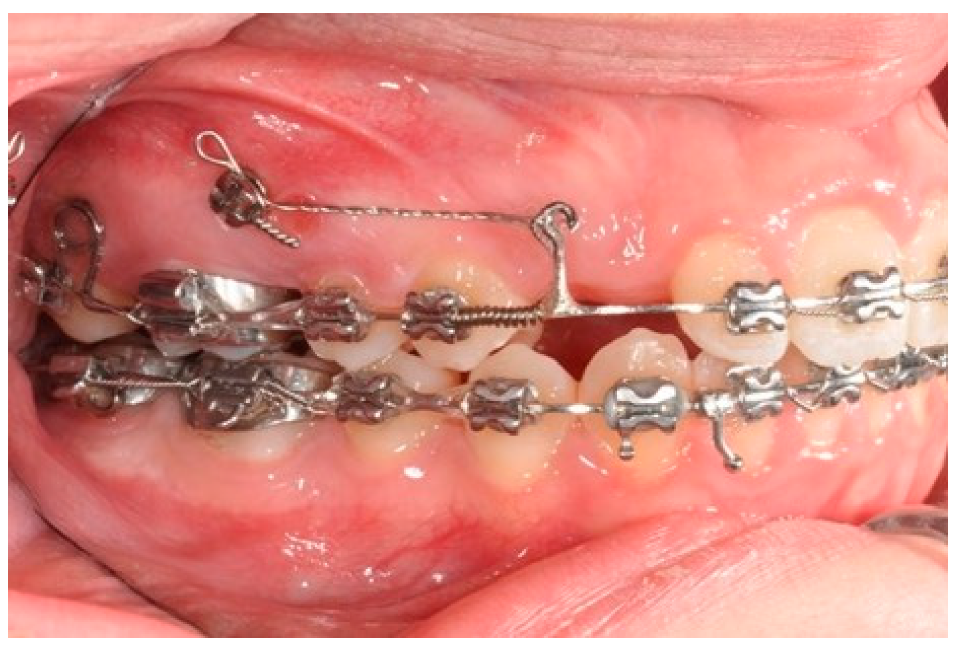 Biomimetics 09 00305 g007