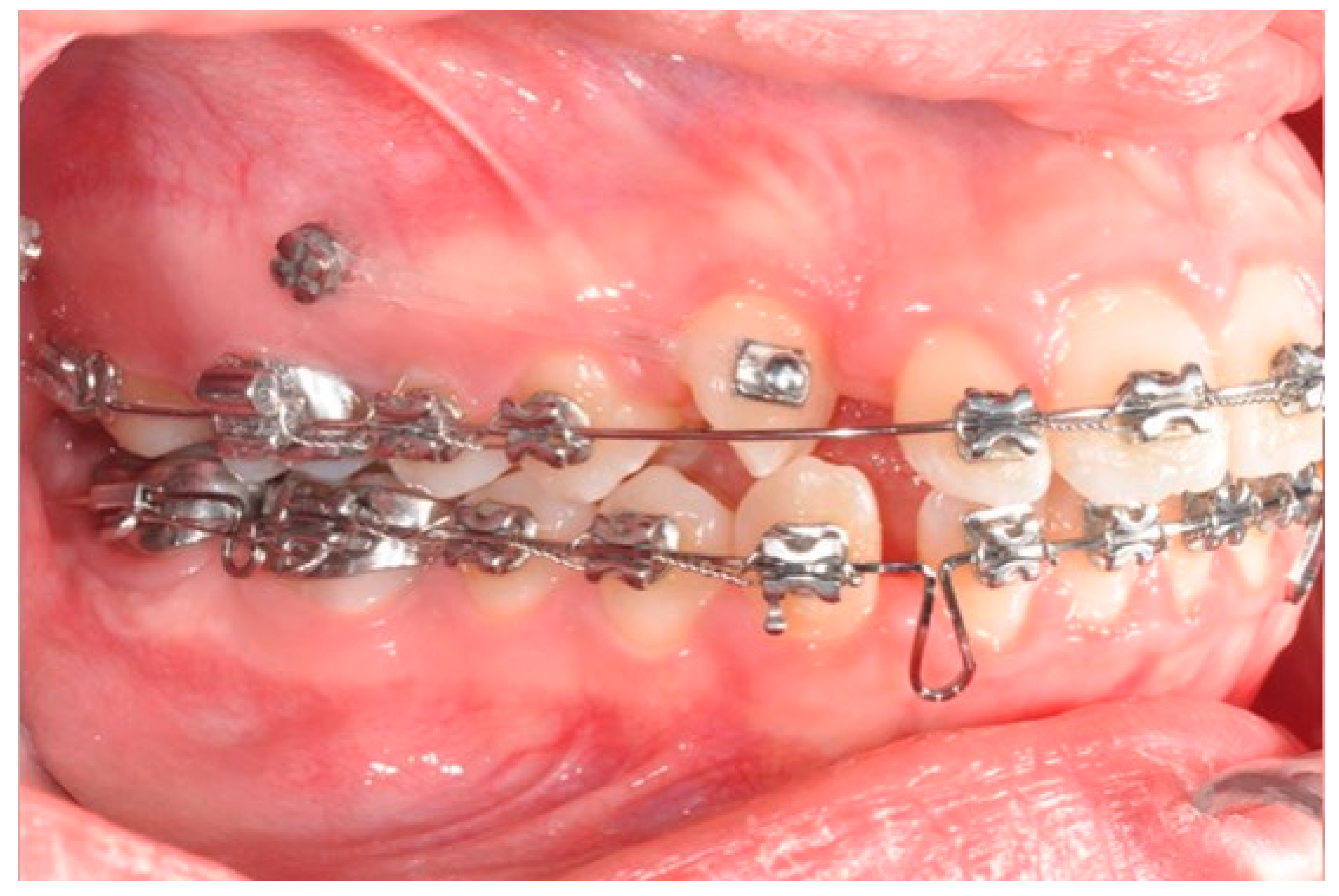 Biomimetics 09 00305 g008