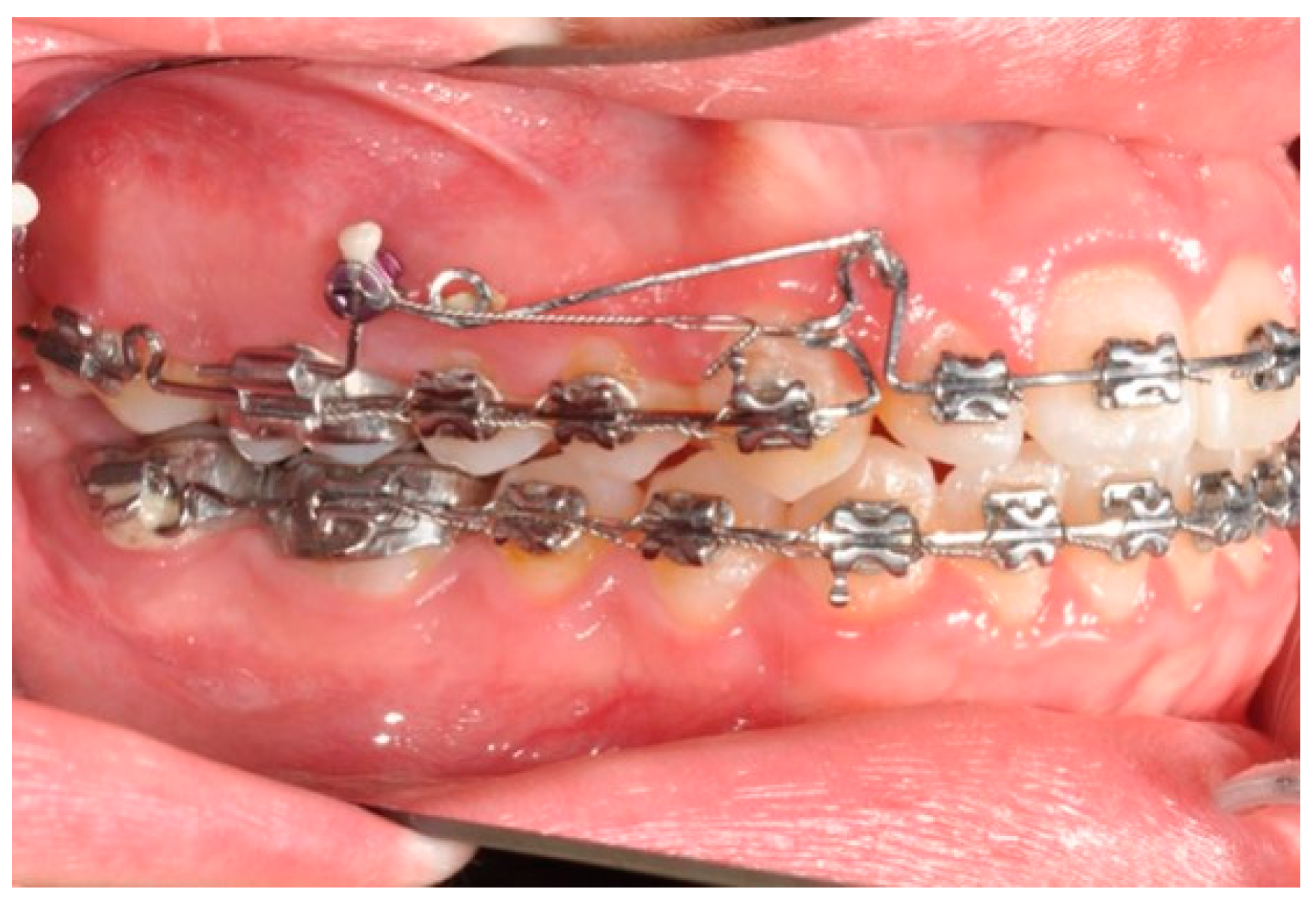 Biomimetics 09 00305 g010