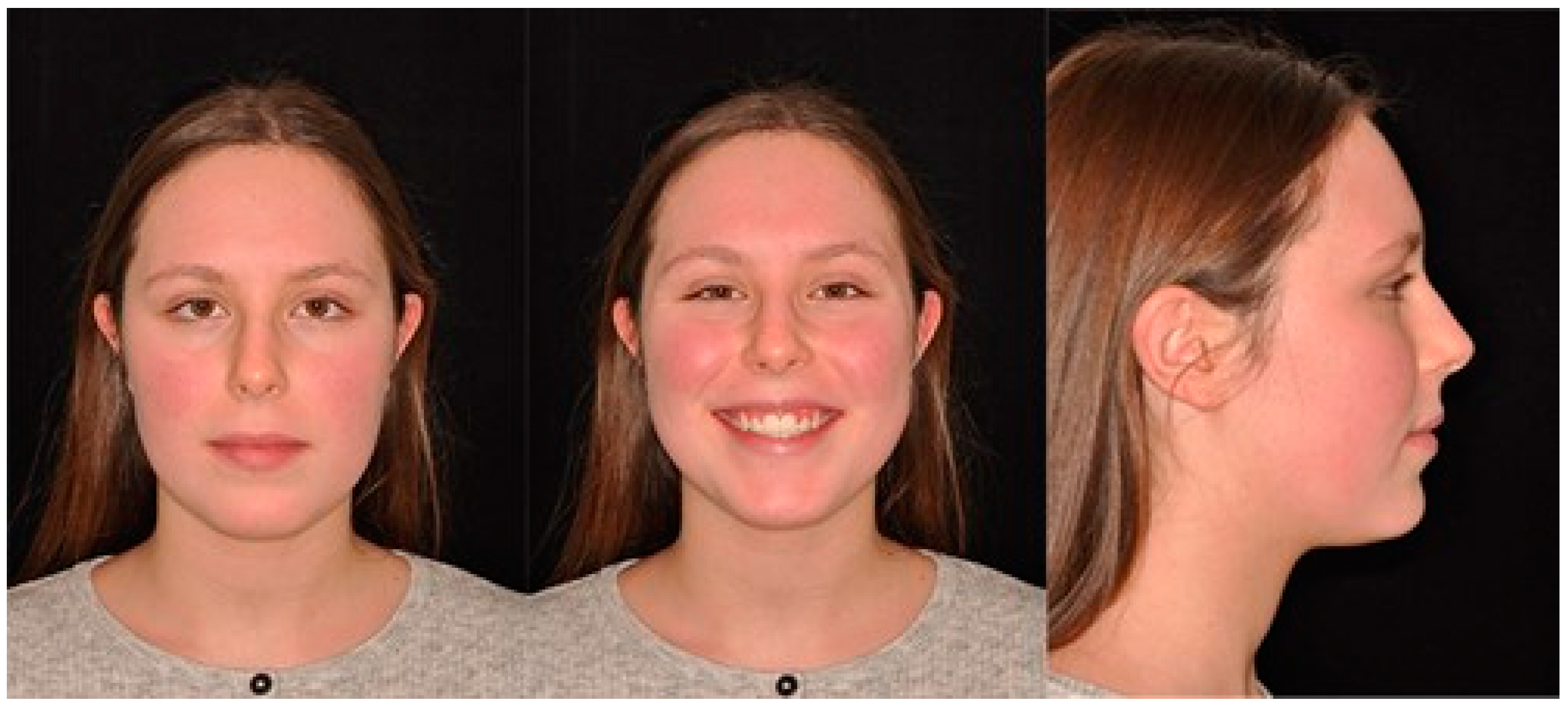 Biomimetics 09 00305 g012