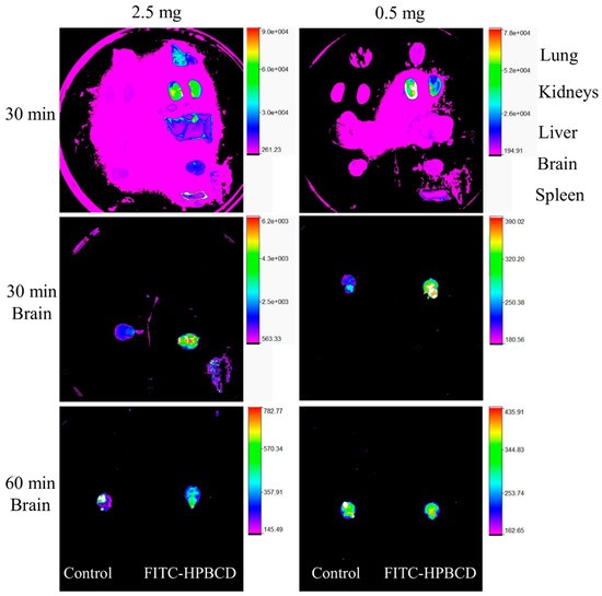 Intrathecal 2-hydroxypropyl-β-cyclodextrin decreases neurological