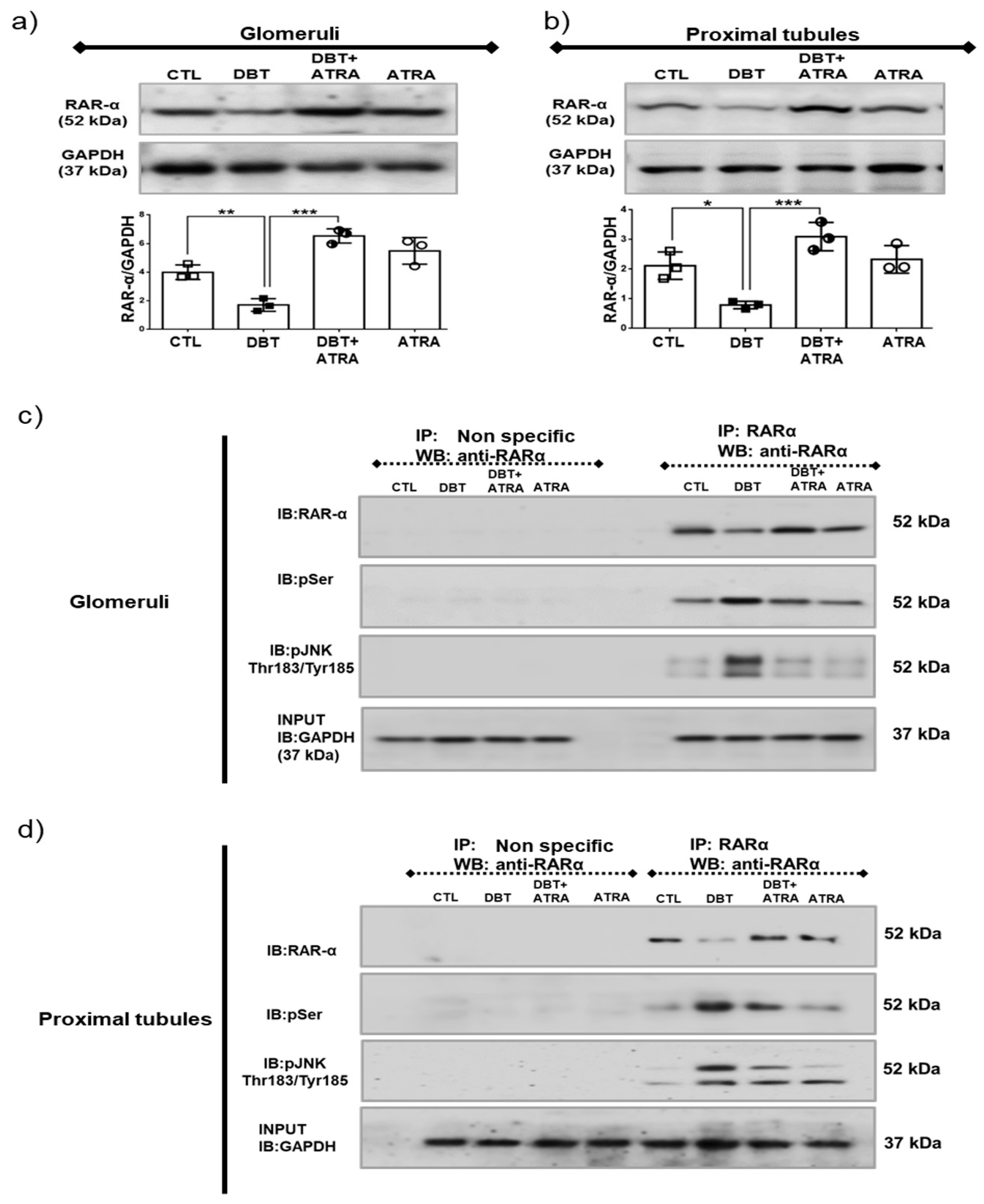 Biomolecules Free Full Text All Trans Retinoic Acid Attenuates Fibrotic Processes By Downregulating Tgf B1 Smad3 In Early Diabetic Nephropathy Html