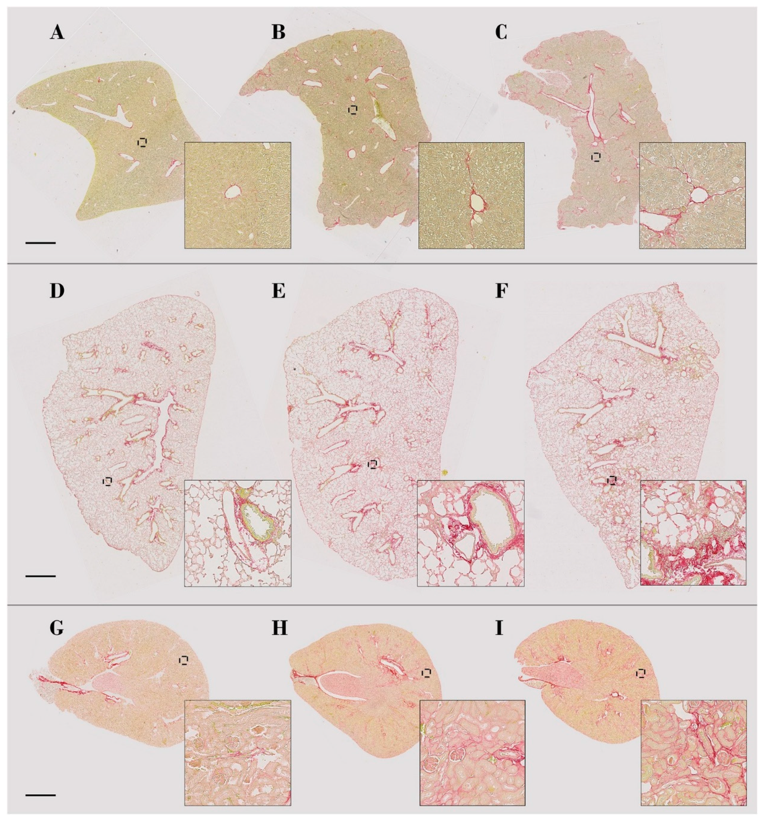 Biomolecules | Free Full-Text | Digital Image Analysis of Picrosirius Red  Staining: A Robust Method for Multi-Organ Fibrosis Quantification and  Characterization