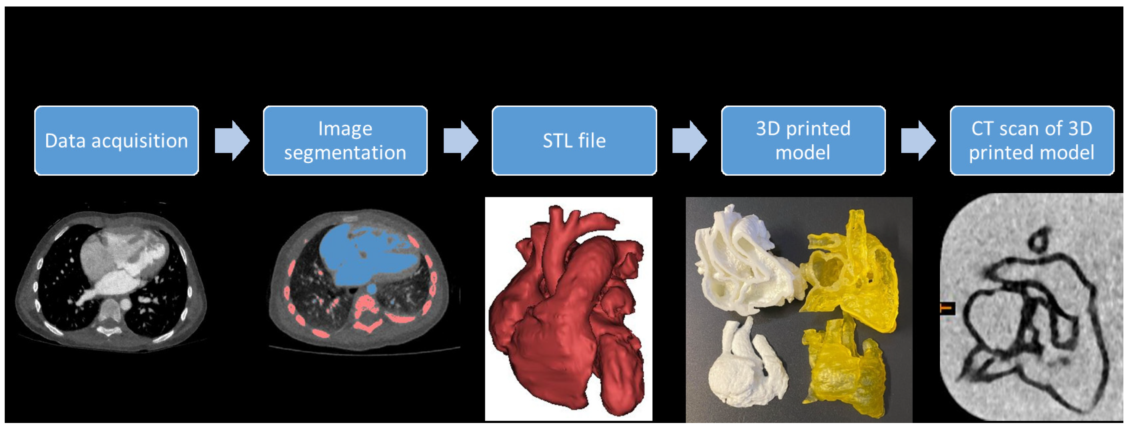 3D model (stl) Heart base mesh