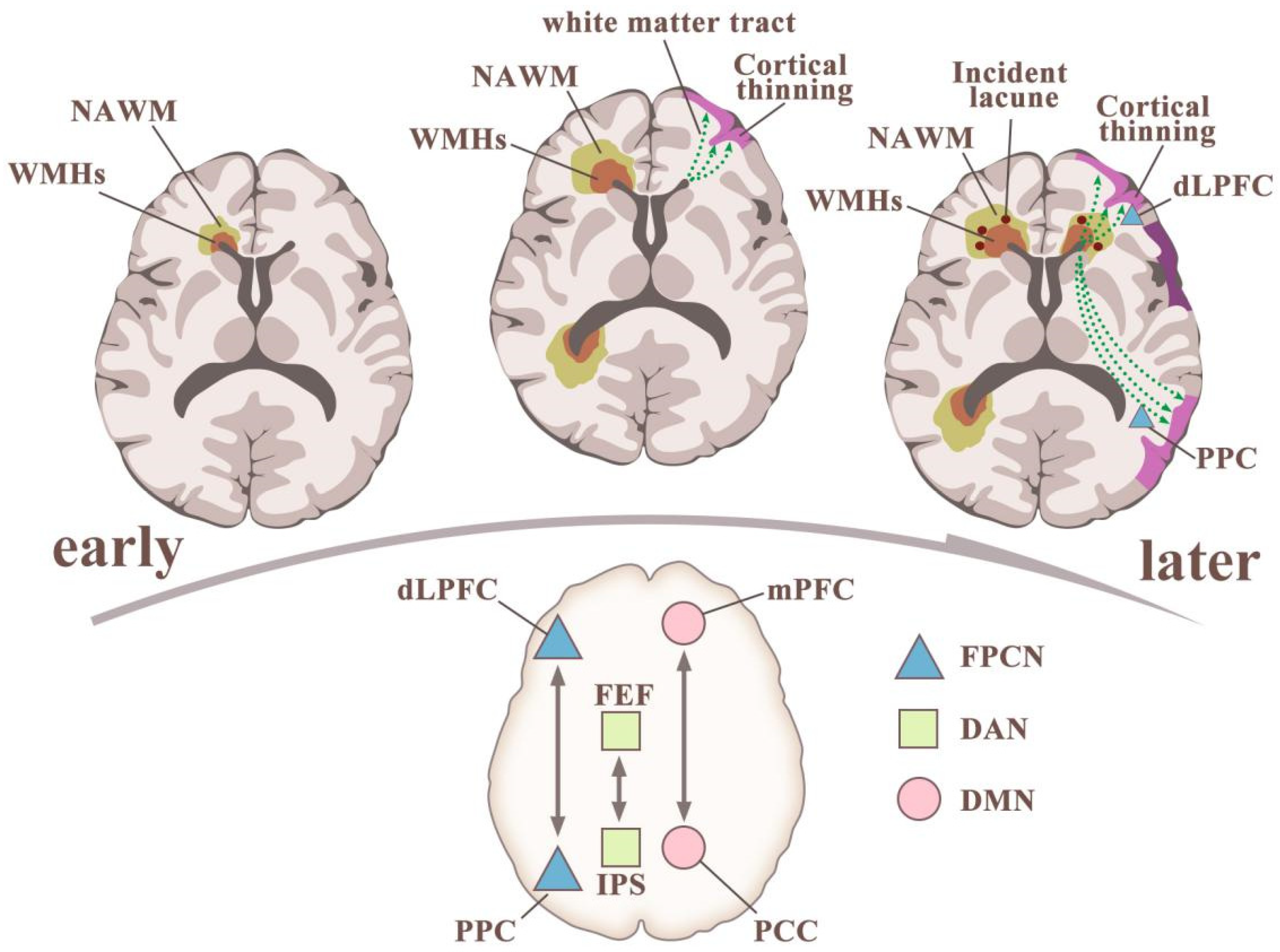 Cognitive impairment