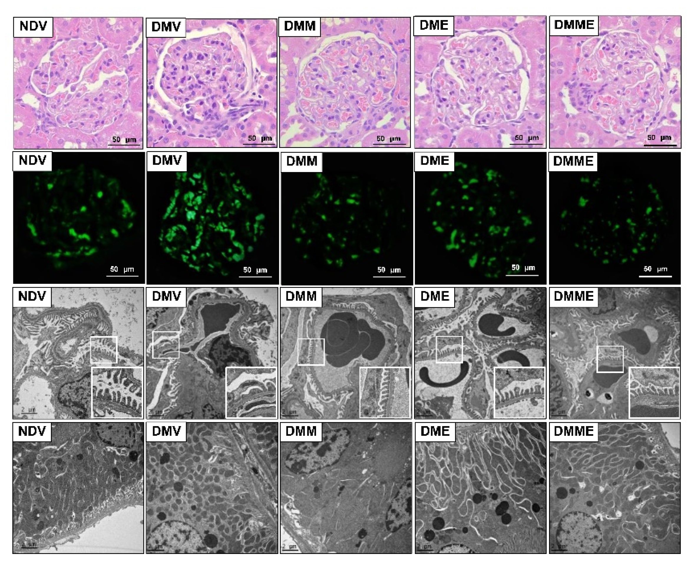 Biomolecules | Free Full-Text | Protective Effects of Purple Rice Husk  against Diabetic Nephropathy by Modulating PGC-1α/SIRT3/SOD2 Signaling and  Maintaining Mitochondrial Redox Equilibrium in Rats | HTML