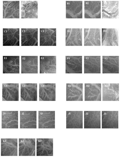 Biomolecules | Free Full-Text | The Effects of Angiotensin II or