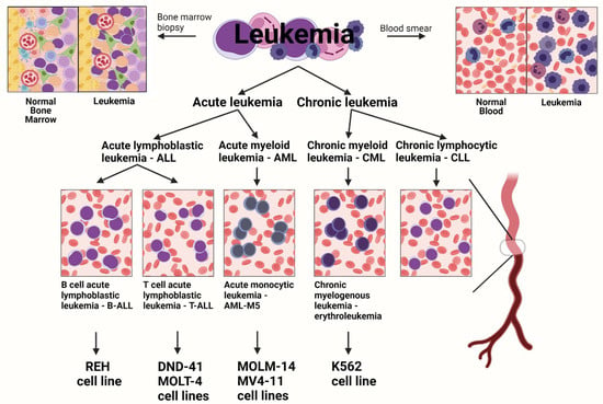 leukemia cells vs normal cells