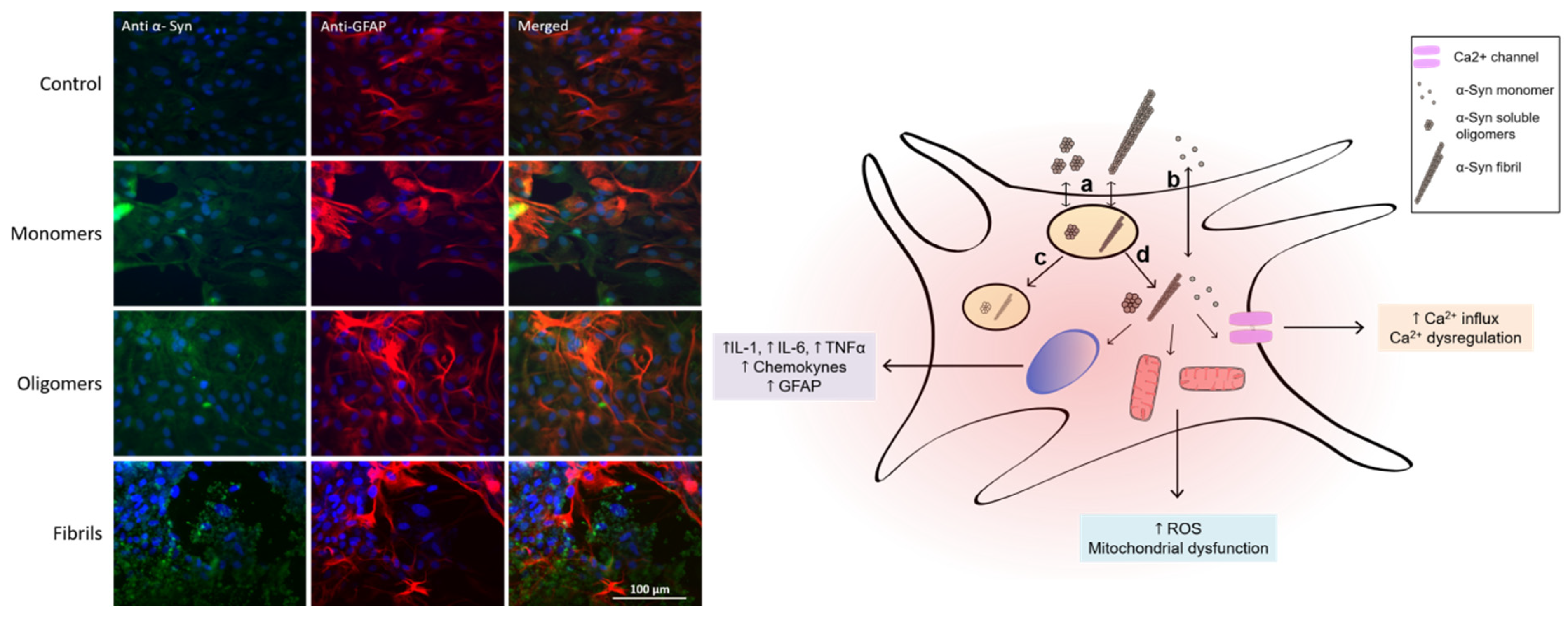 Frontiers  Reactive Astrocytes: Critical Players in the