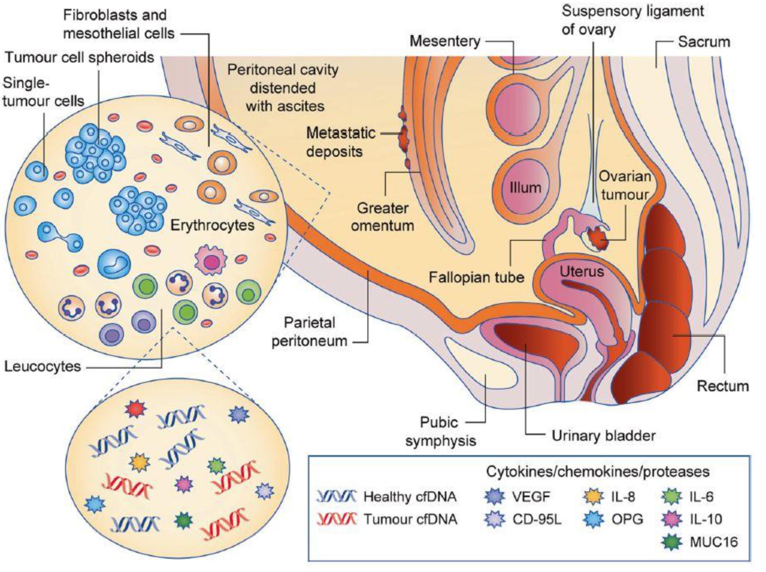Biomolecules | Free Full-Text | In Vitro Models of Ovarian Cancer: Bridging  the Gap between Pathophysiology and Mechanistic Models
