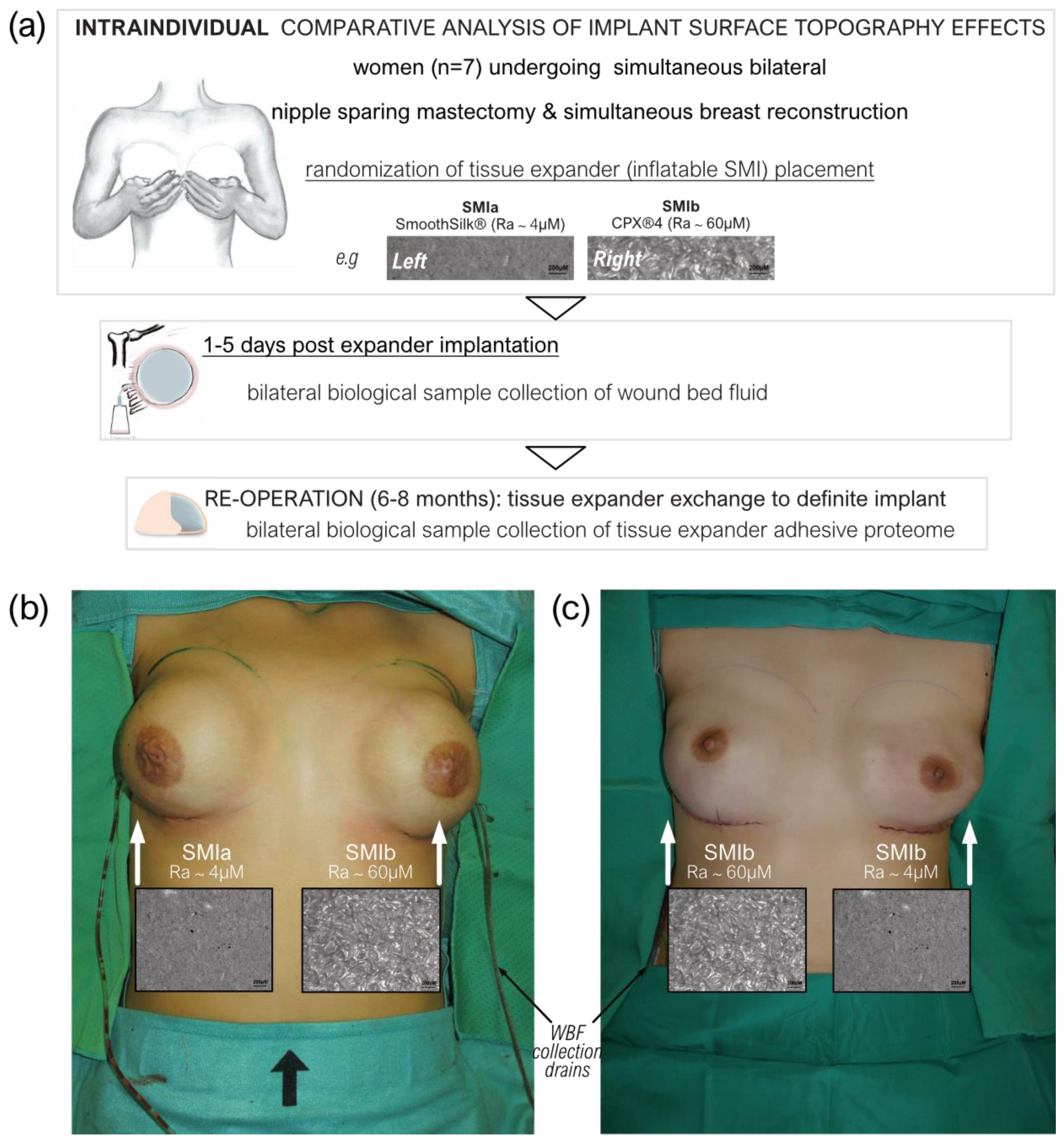 Biomolecules Free Full-Text Quantitative Proteomic Characterization of Foreign Body Response towards Silicone Breast Implants Identifies Chronological Disease-Relevant Biomarker Dynamics photo