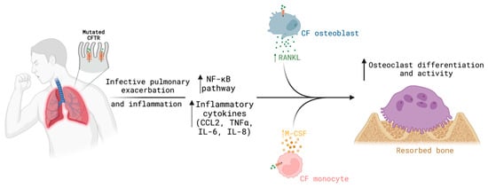 Biomolecules | Free Full-Text | Cystic Fibrosis Bone Disease: The ...