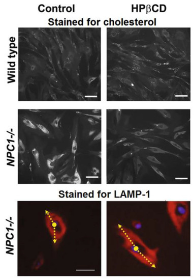 Intrathecal 2-hydroxypropyl-β-cyclodextrin decreases neurological