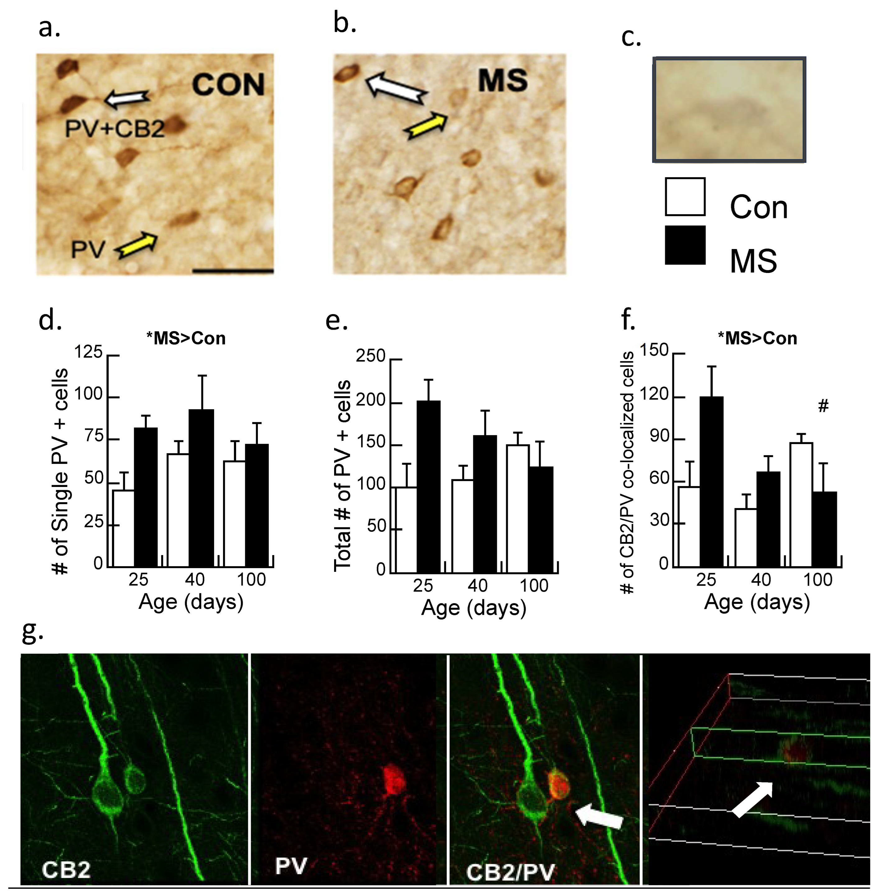 Biomolecules | Free Full-Text | Increasing CB2 Receptor Activity 