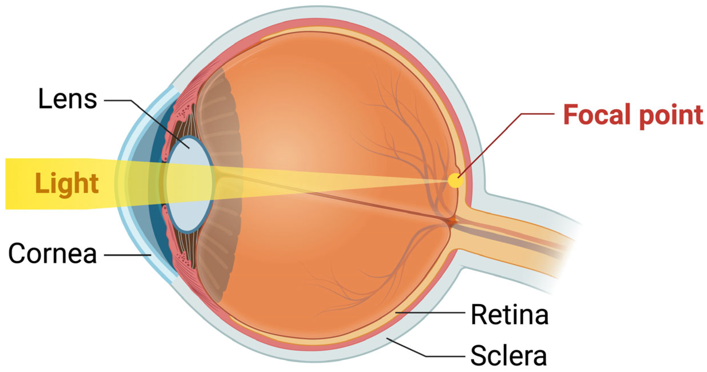 Oxidative Stress and Cataract Formation: Evaluating the Efficacy 