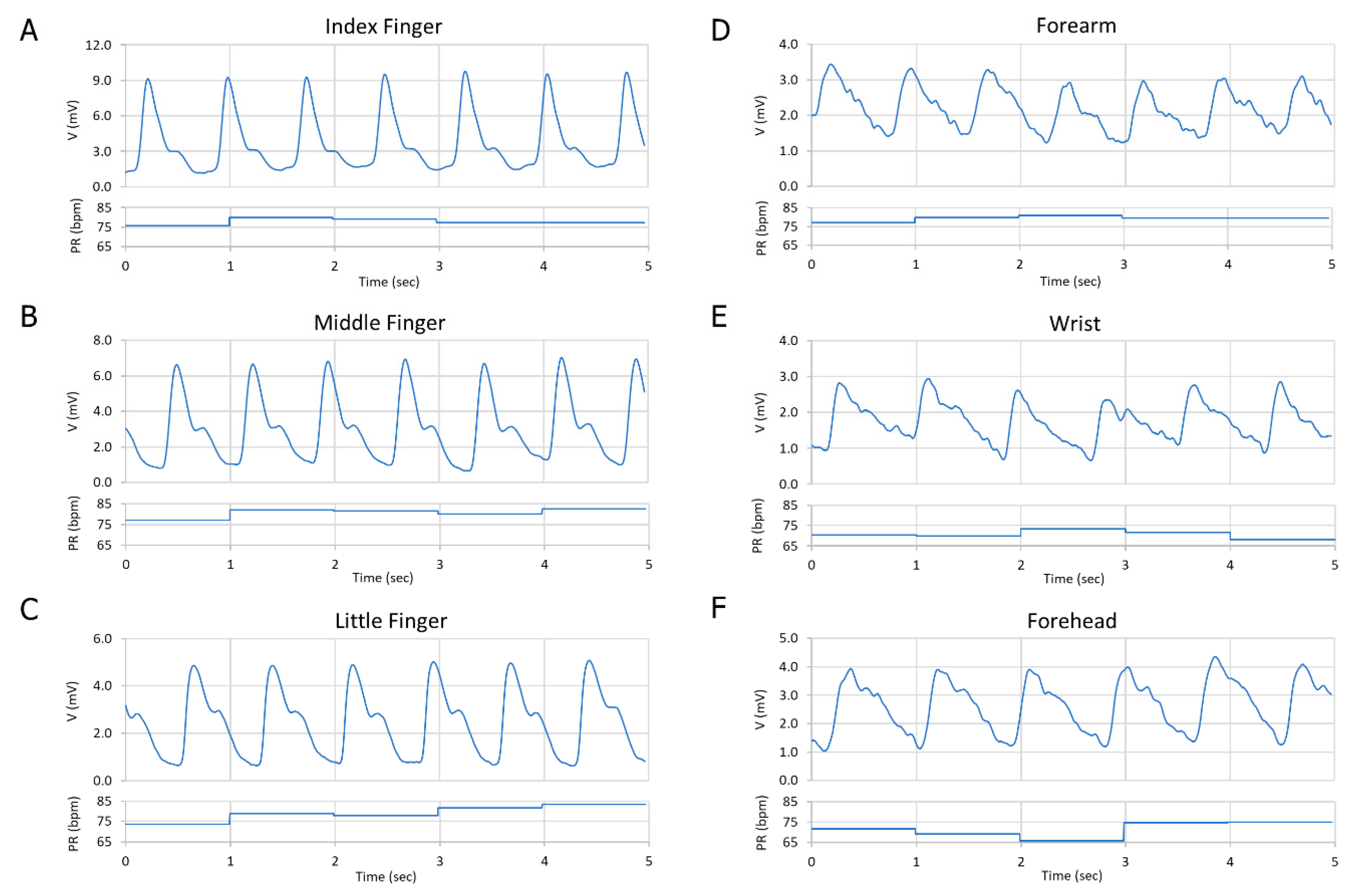 Biosensors 09 00048 g008 Biosensors 09 00048 g008