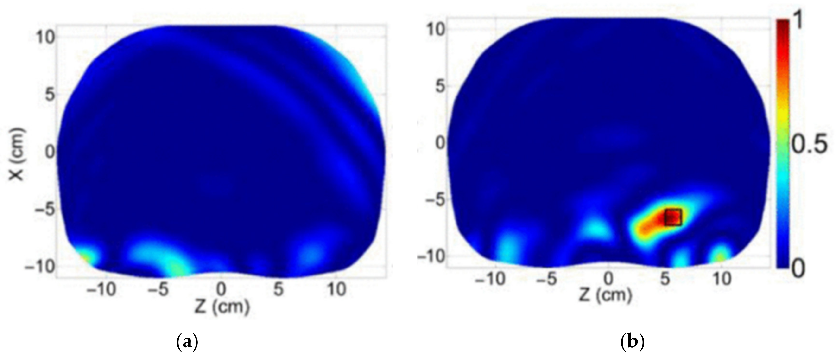 Biosensors 11 00135 g025