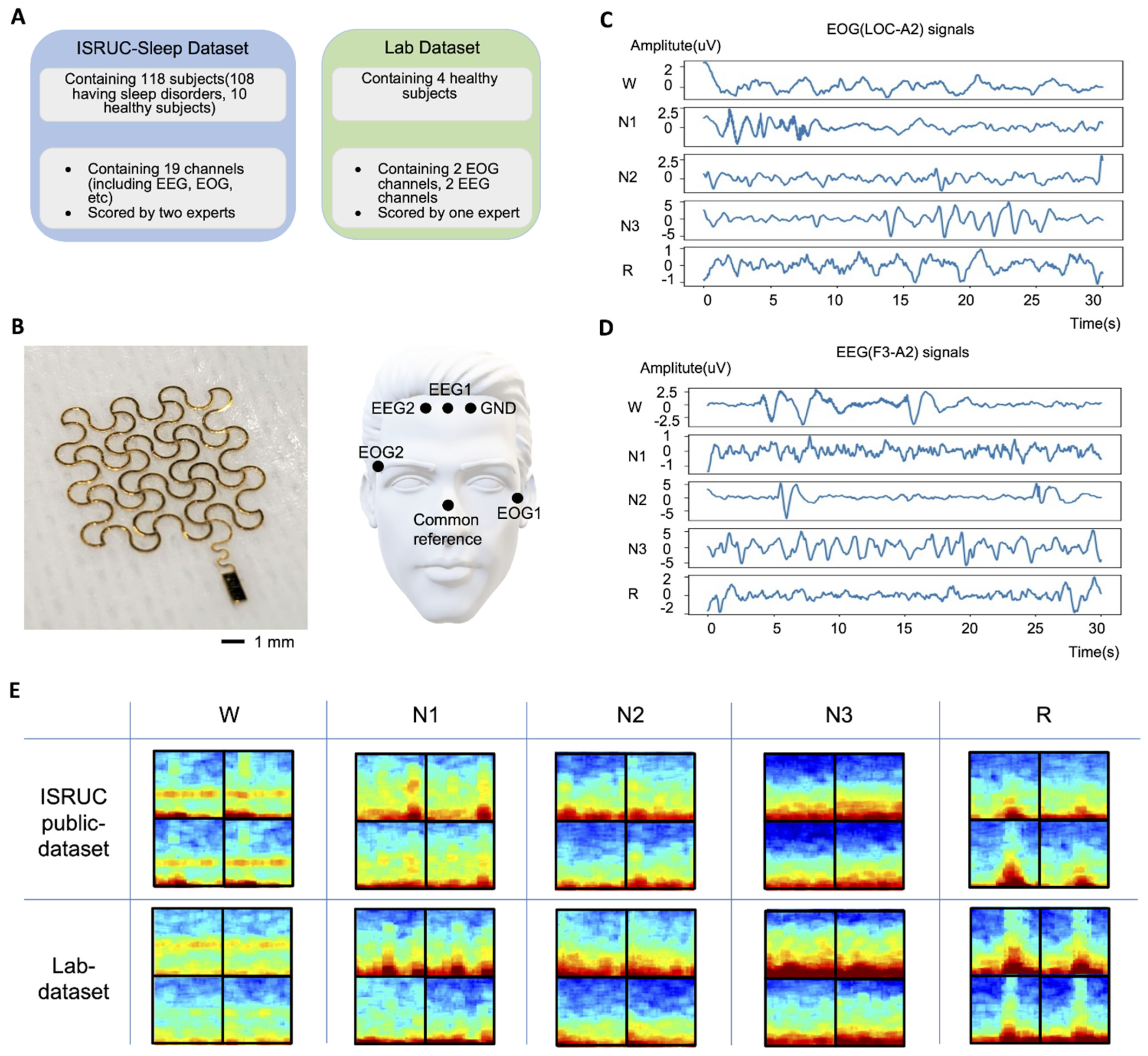 At-home wireless monitoring of acute hemodynamic disturbances to detect  sleep apnea and sleep stages via a soft sternal patch