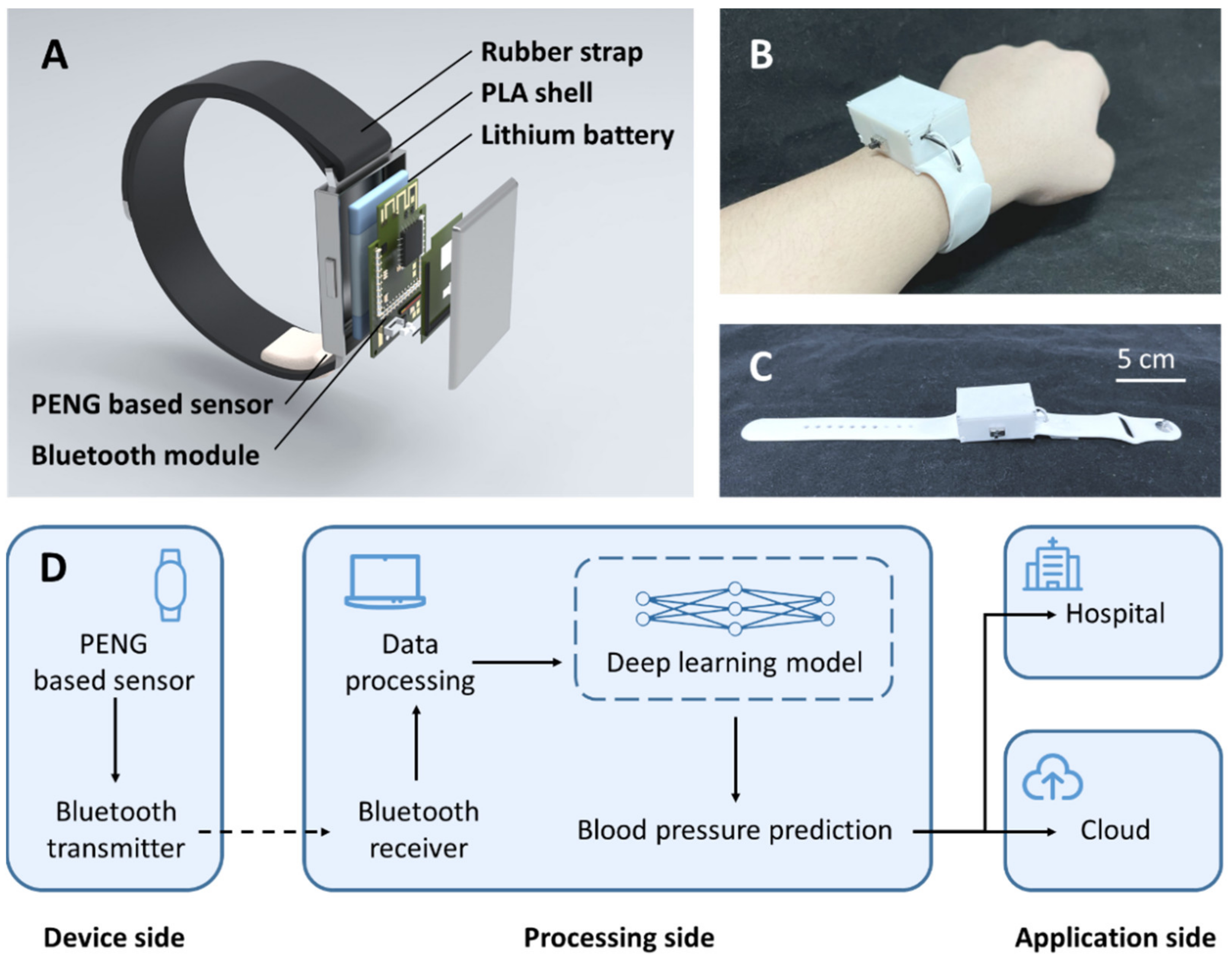 Biosensors | Free Full-Text | An Artificial Intelligence-Enhanced Blood  Pressure Monitor Wristband Based on Piezoelectric Nanogenerator