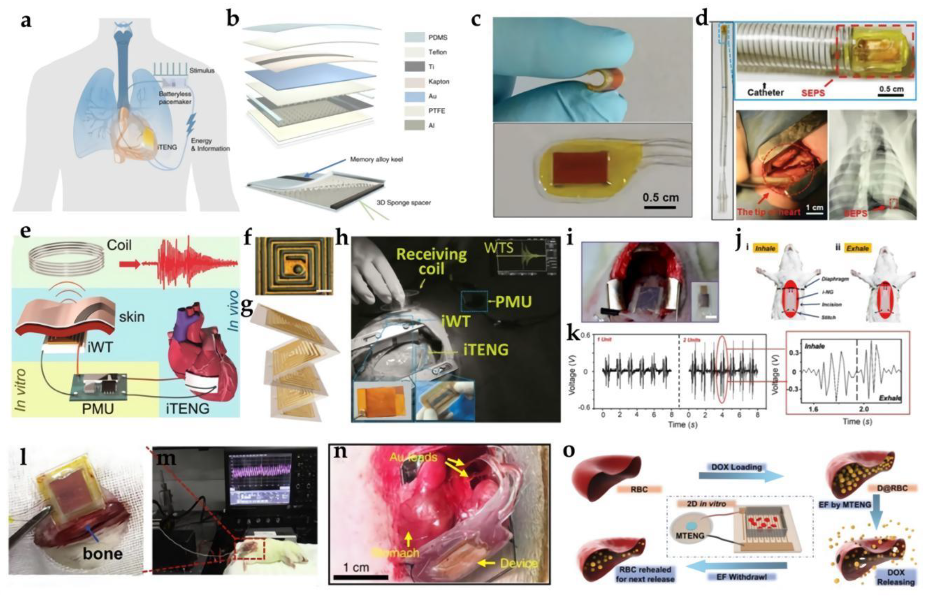 Biosensors 12 00323 g006