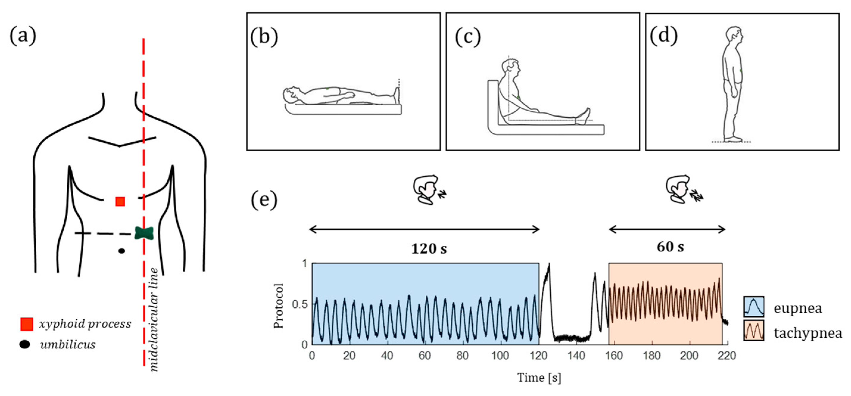 Biosensors 12 00363 g008