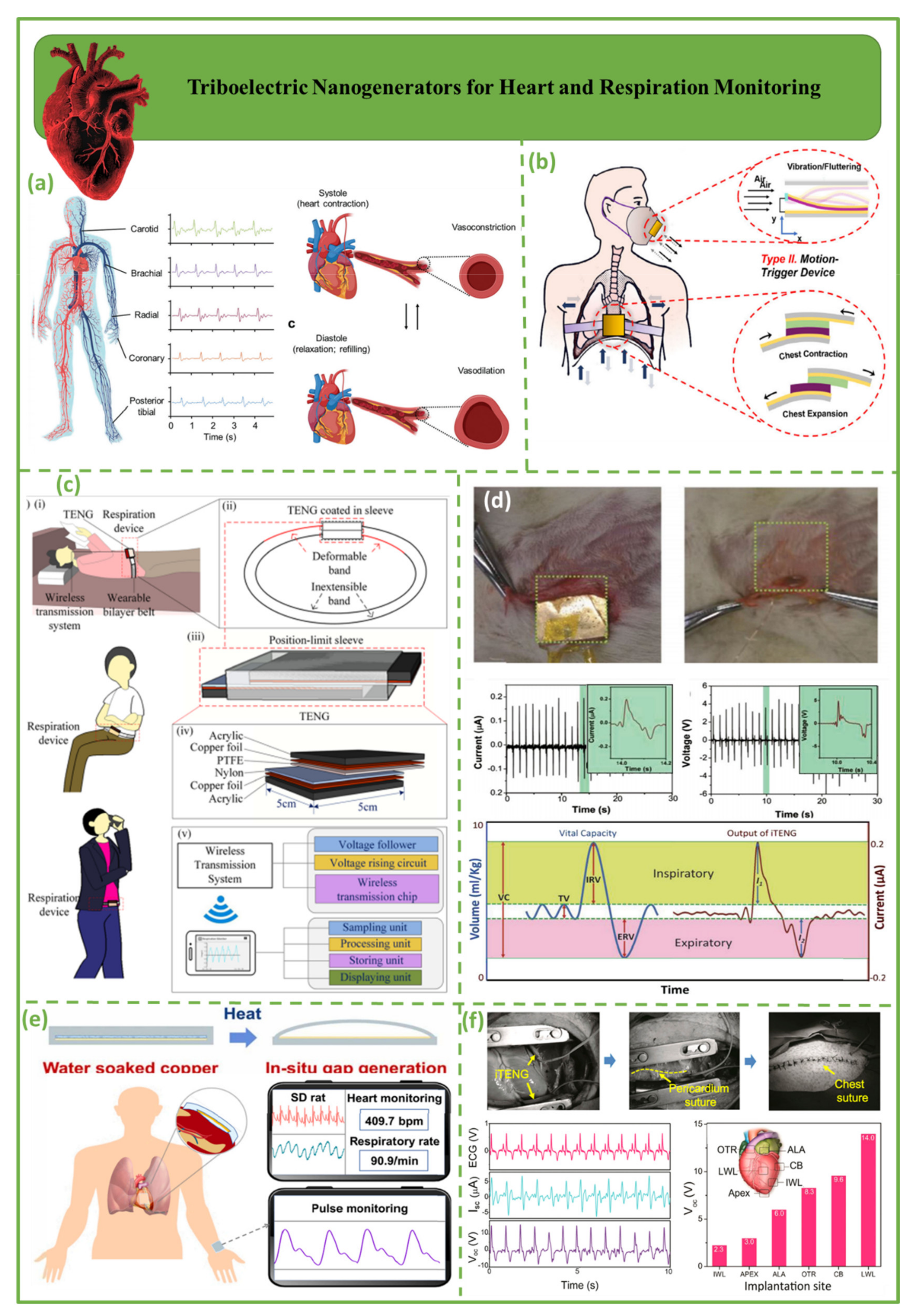 Biosensors 12 00697 g005