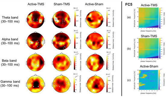 Biosensors | Free Full-Text | Investigation of Spatiotemporal Profiles of  Single-Pulse TMS-Evoked Potentials with Active Stimulation Compared with a  Novel Sham Condition