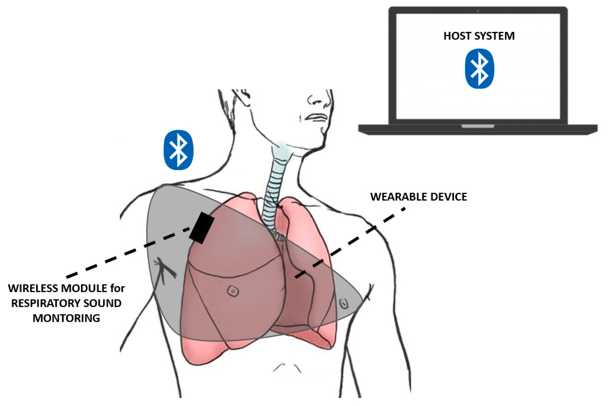 Biosensors 12 00835 g012