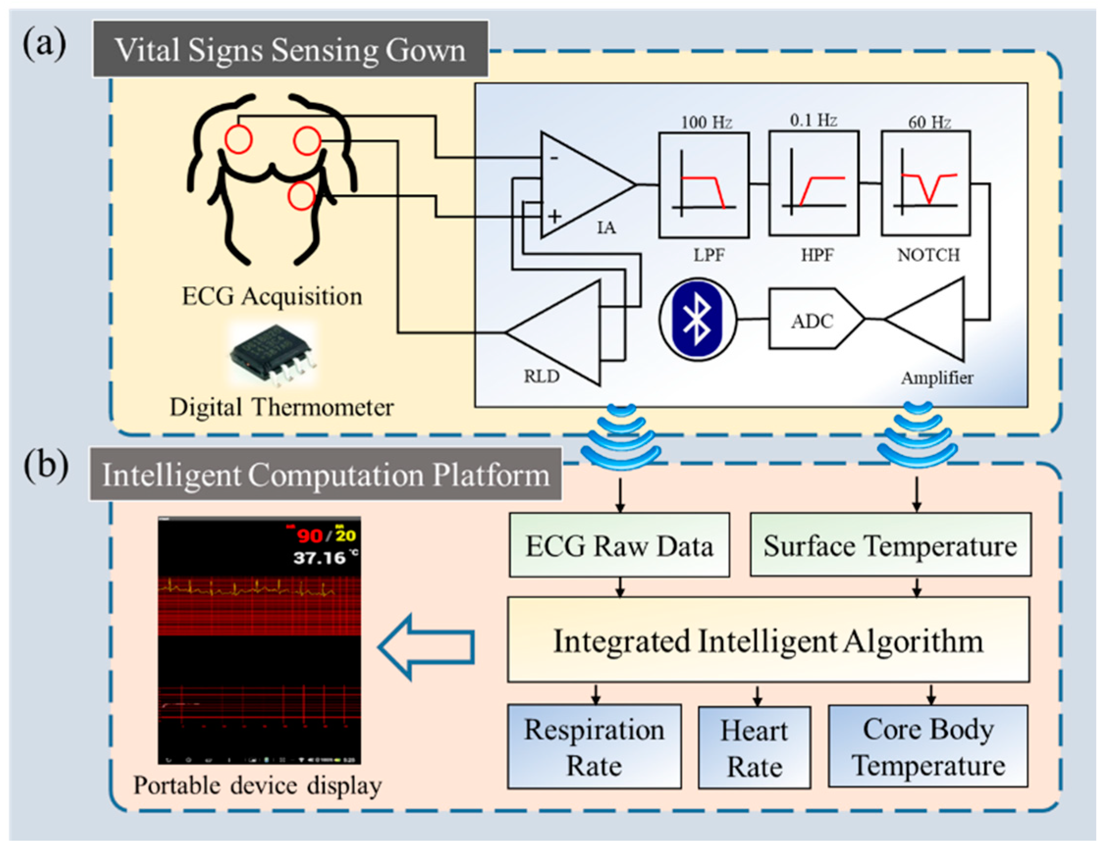 Biosensors 12 00964 g001 Biosensors 12 00964 g001