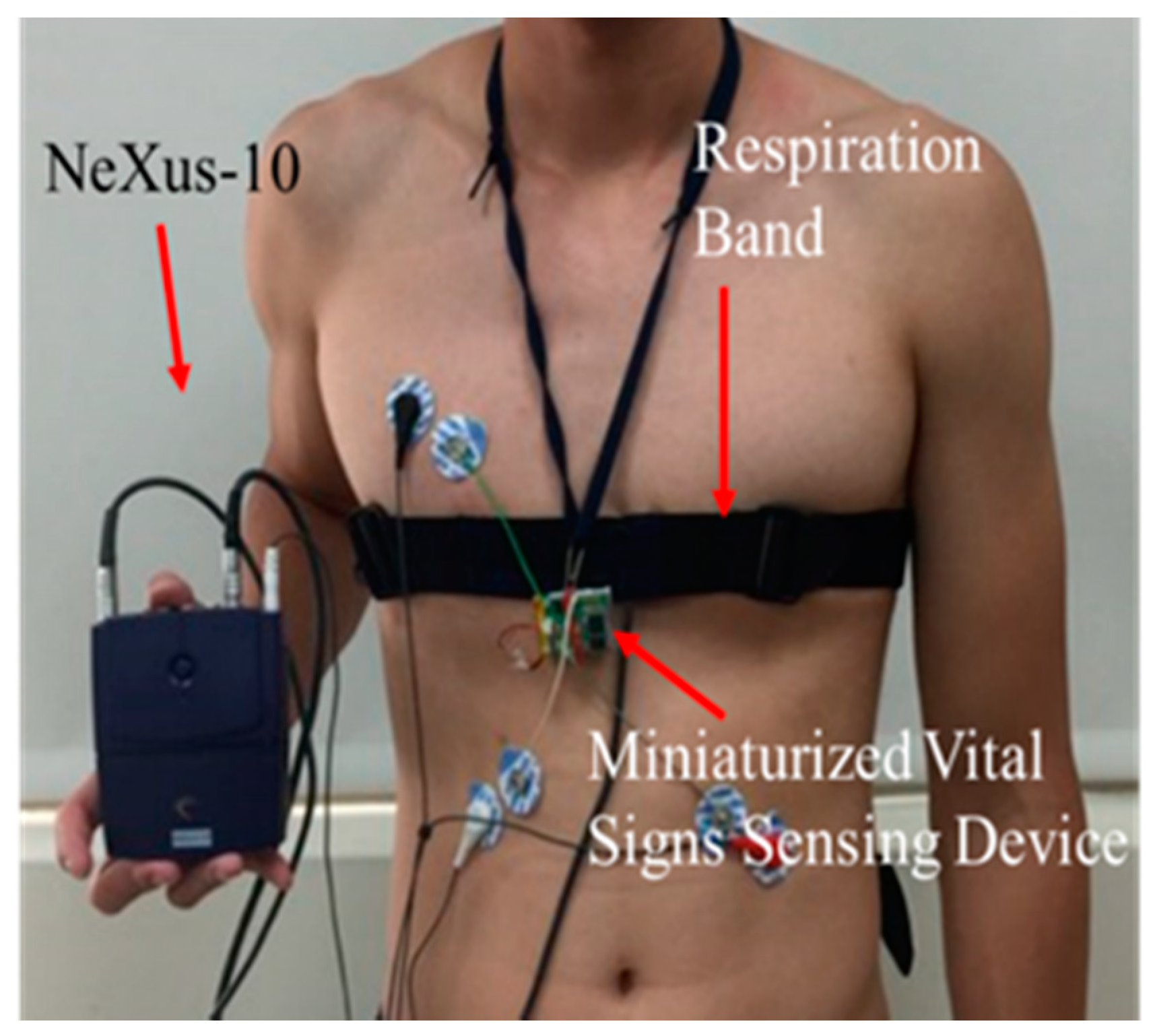 Biosensors 12 00964 g006 Biosensors 12 00964 g006