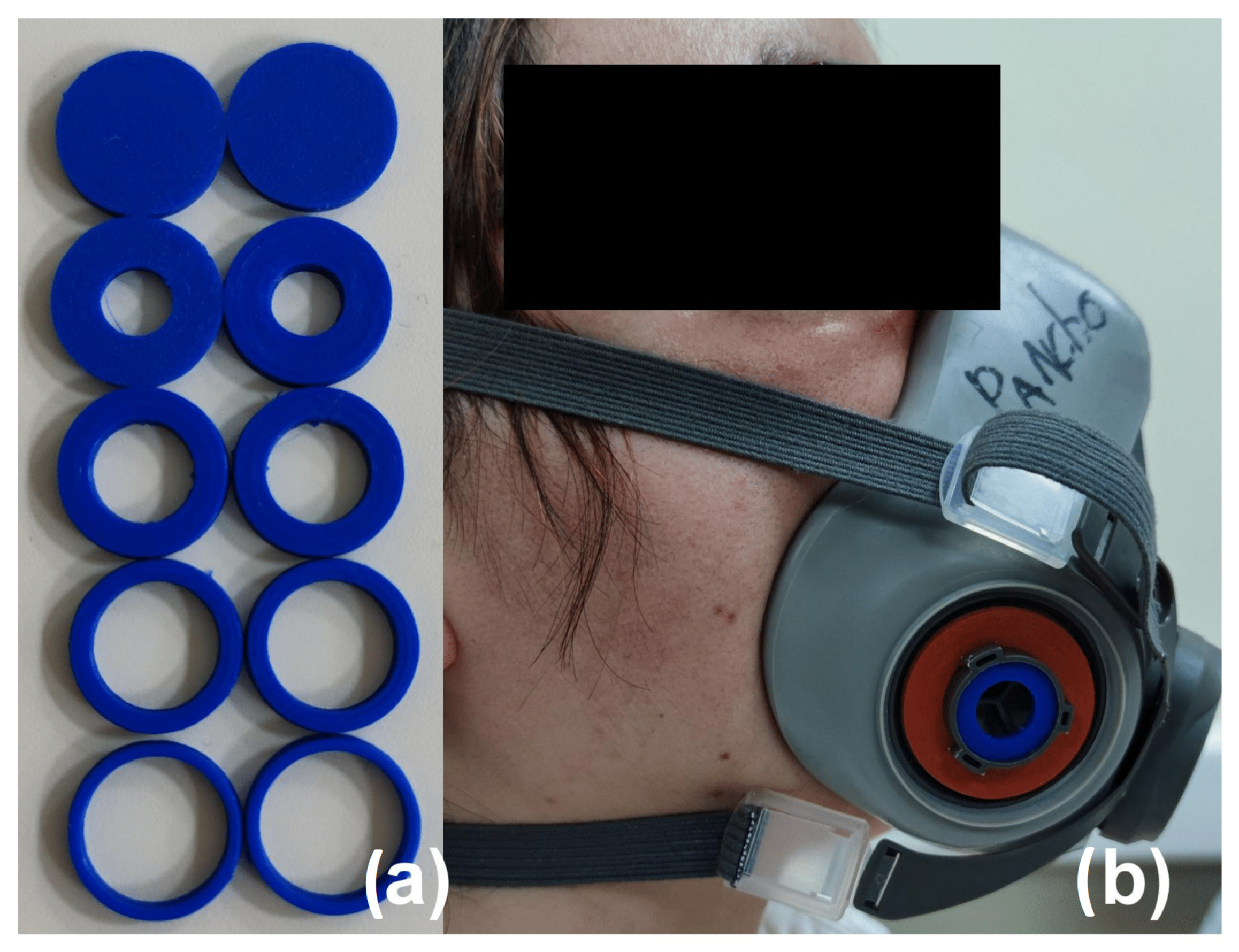 Biosensors 12 00991 g008 Biosensors 12 00991 g008