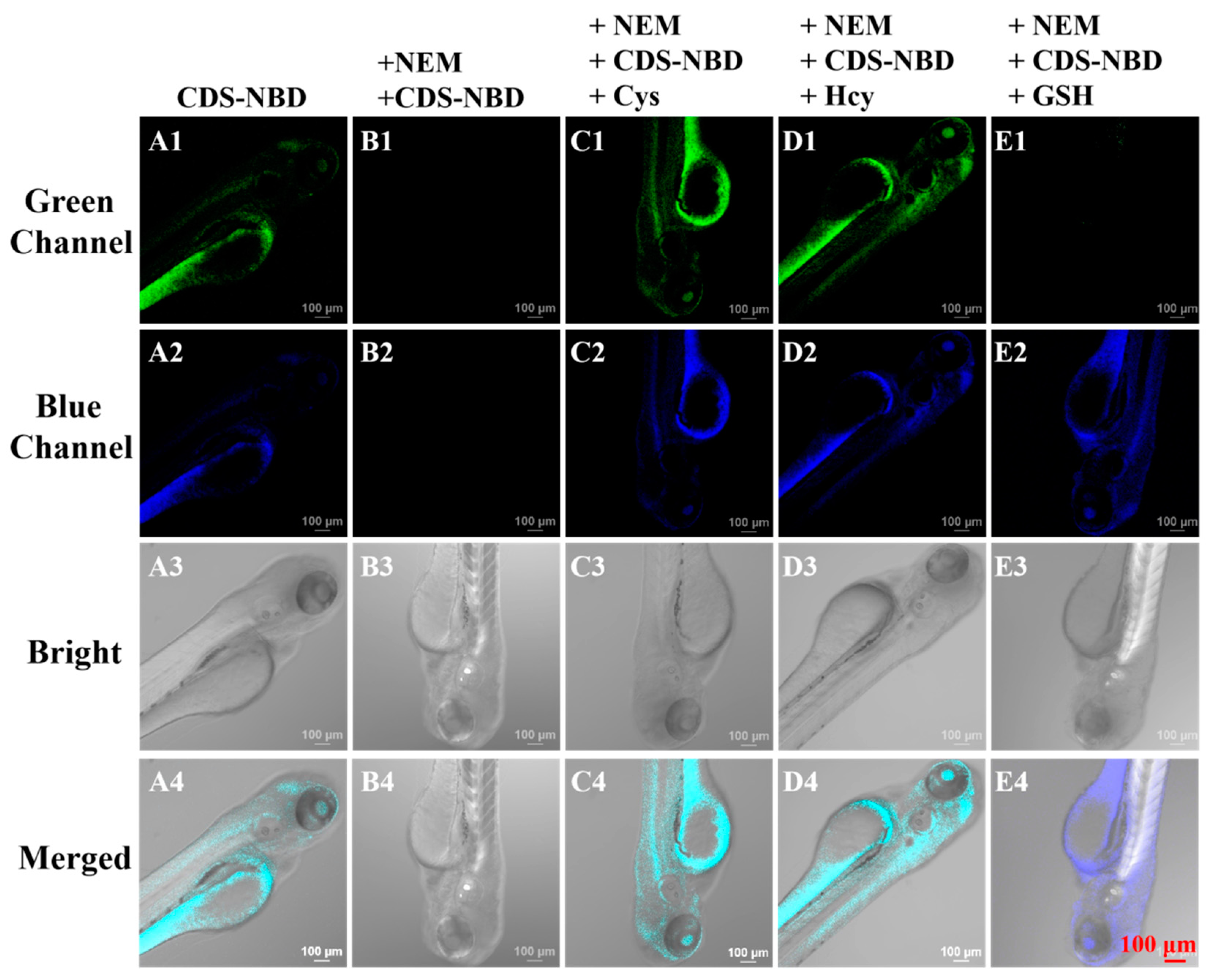 Biosensors 12 01056 g004 Biosensors 12 01056 g004