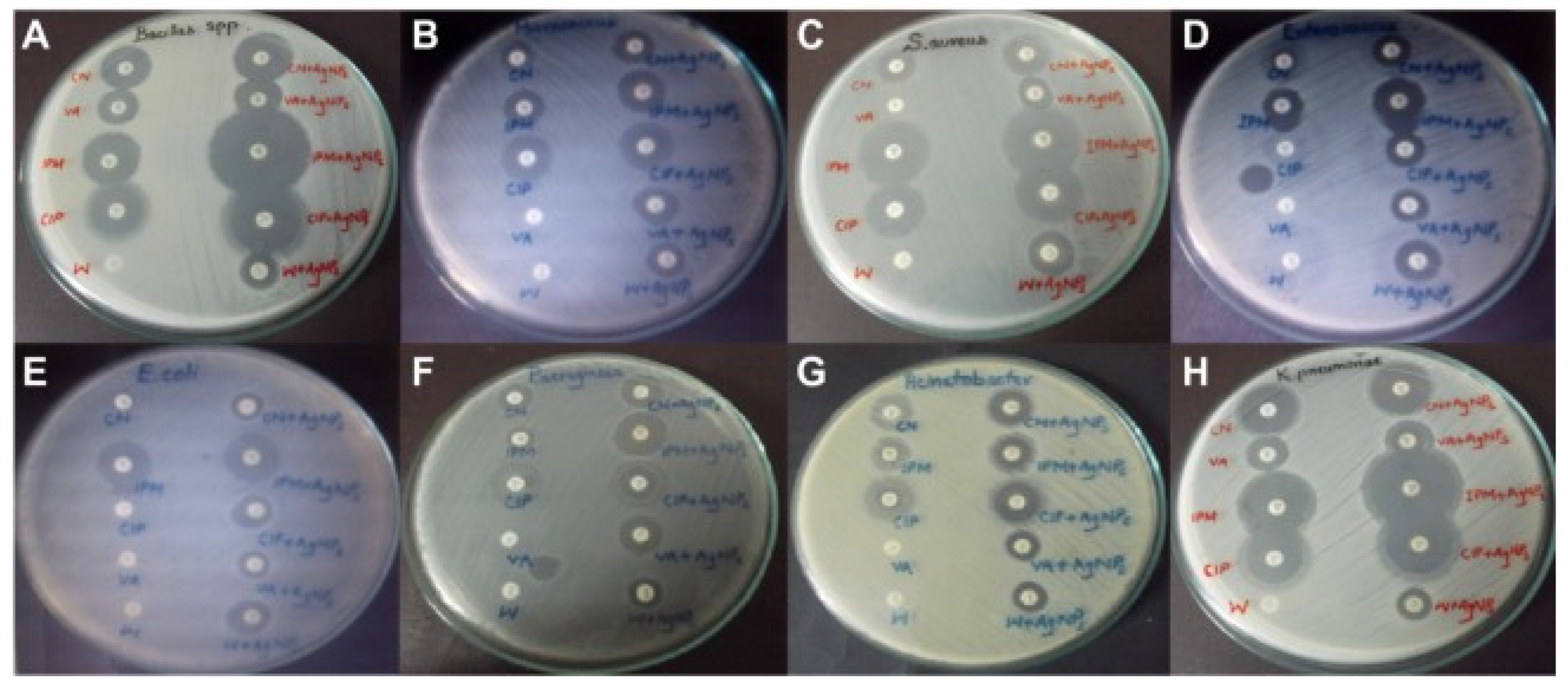 Biosensors 12 01155 g005 Biosensors 12 01155 g005