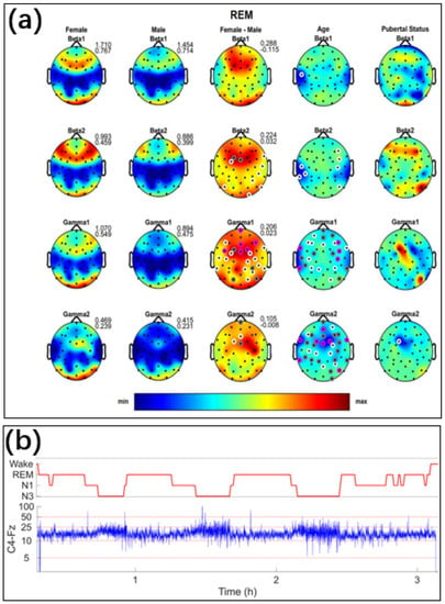 Biosensors, Free Full-Text