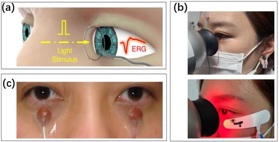 Week In Wearables: Apple Watch App To Combat Snoring, Nokia Health, Smart  Contact Lenses