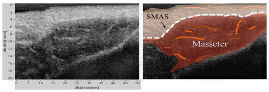 Versatile Single-Element Ultrasound Imaging Platform using a Water-Proofed  MEMS Scanner for Animals and Humans