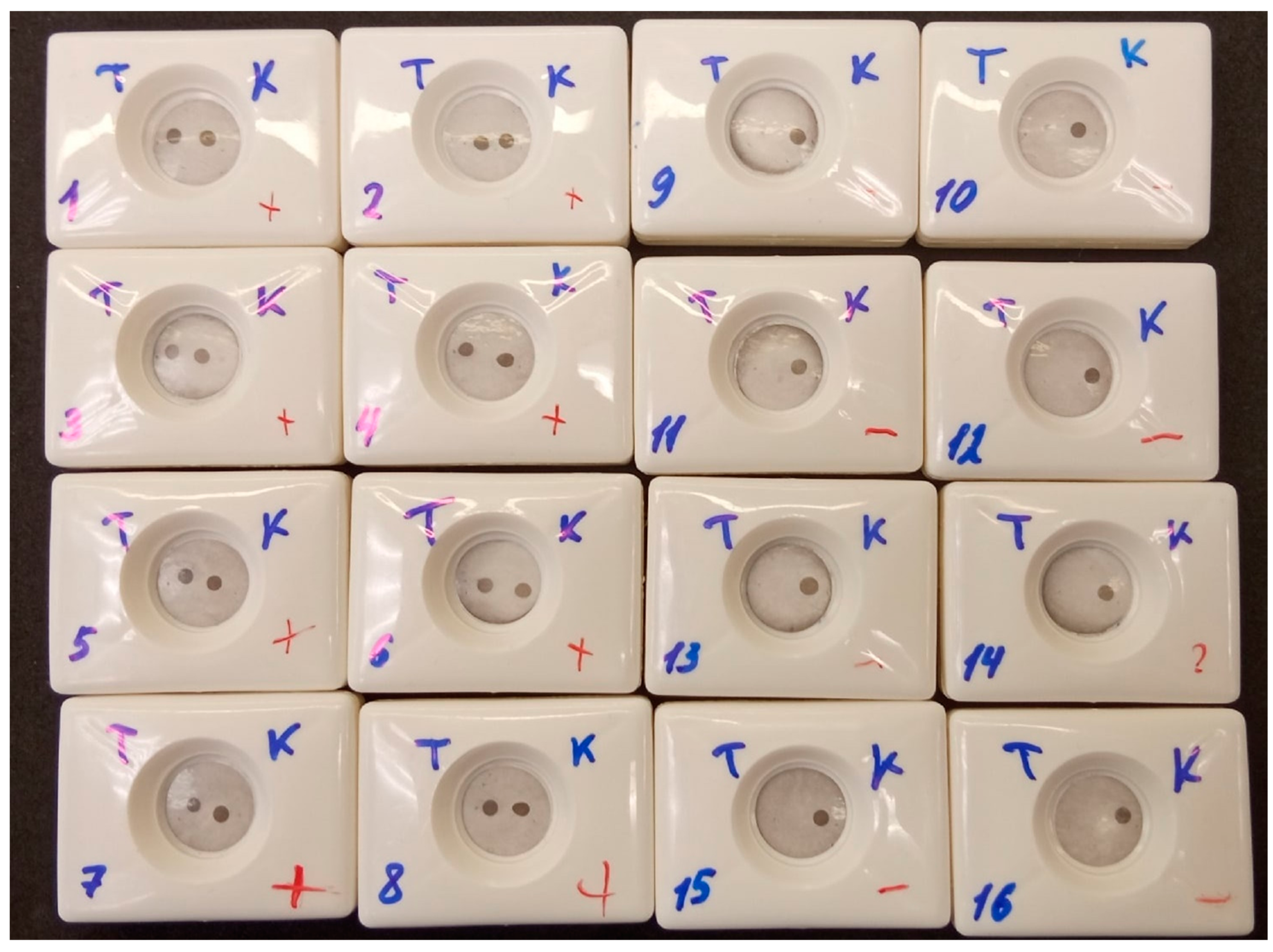 Biosensors 13 00857 g011 Biosensors 13 00857 g011